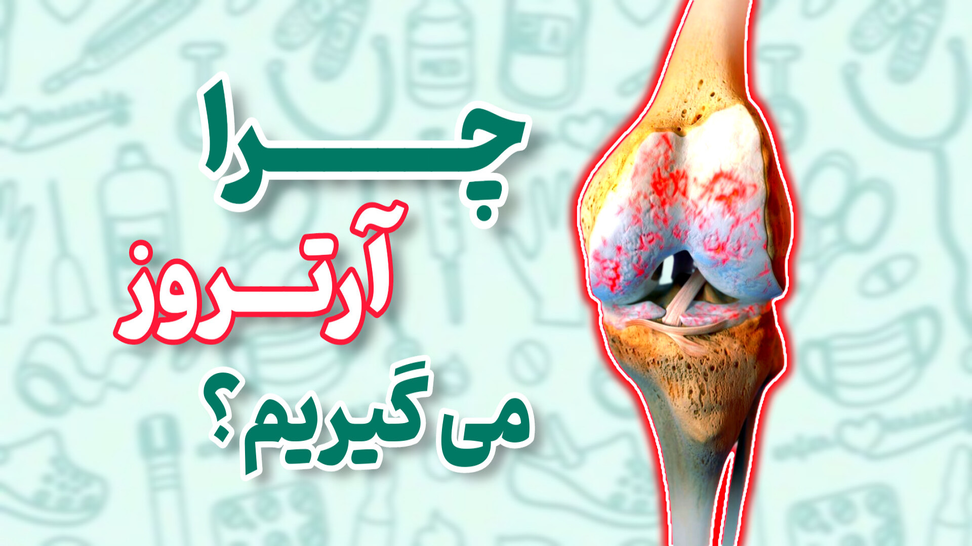 چرا آرتروز میگیریم؟ دکتر محمود جعفر بیگلو