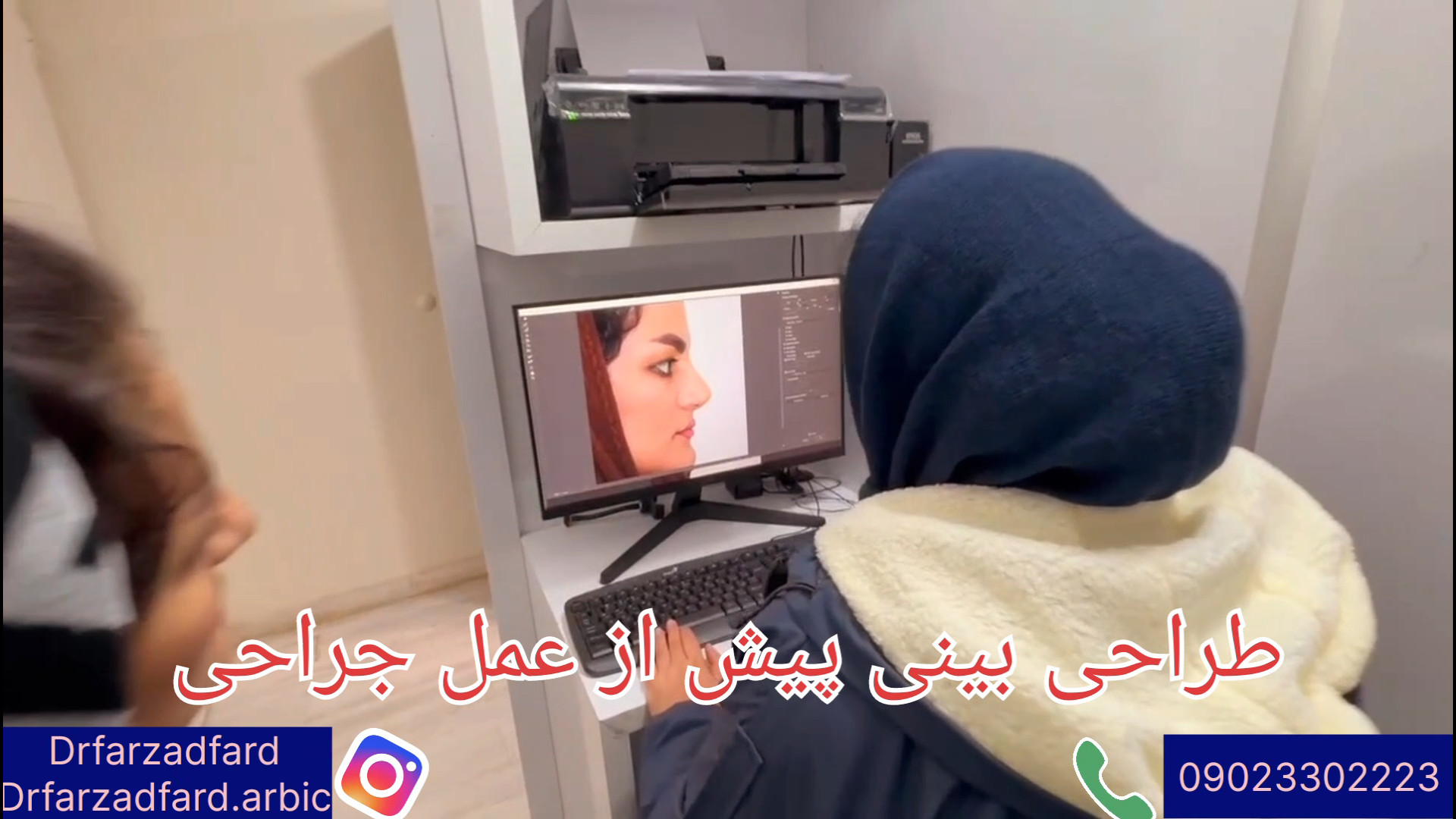 طراحی بینی قبل از عمل جراحی دکتر اسماعیل فرزاد فرد - فوق تخصص پلاستیک