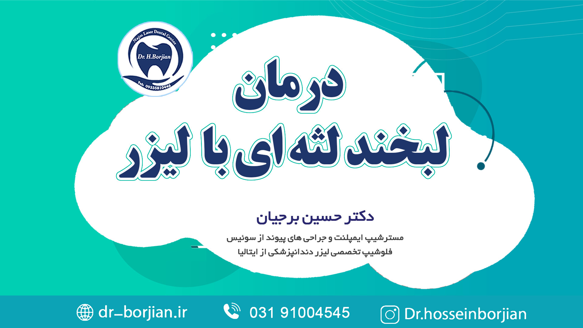 درمان لبخند لثه ای با لیزر | لیزر دندانپزشکی بیماری ترومبوسایتوز اسنشیال