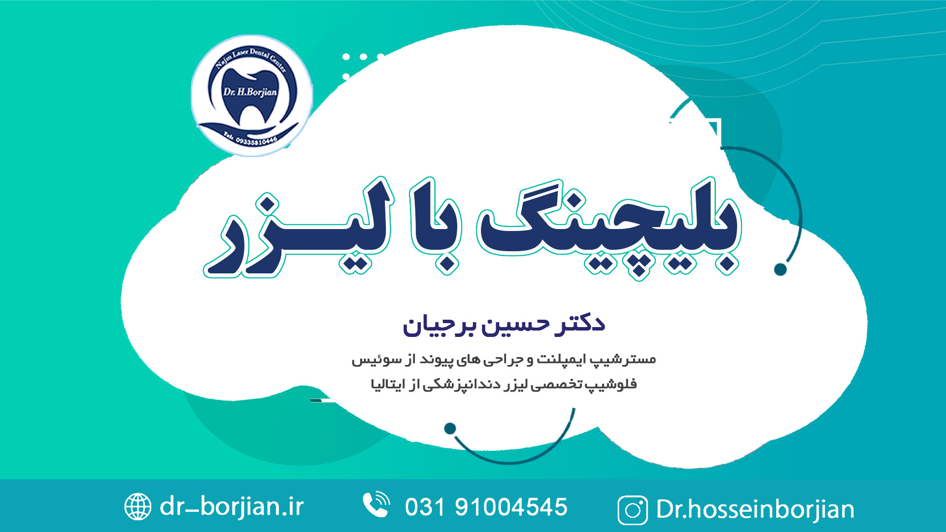 بلیچینگ یا سفید کردن دندان با لیزر | لیزر دندانپزشکی ASO Test