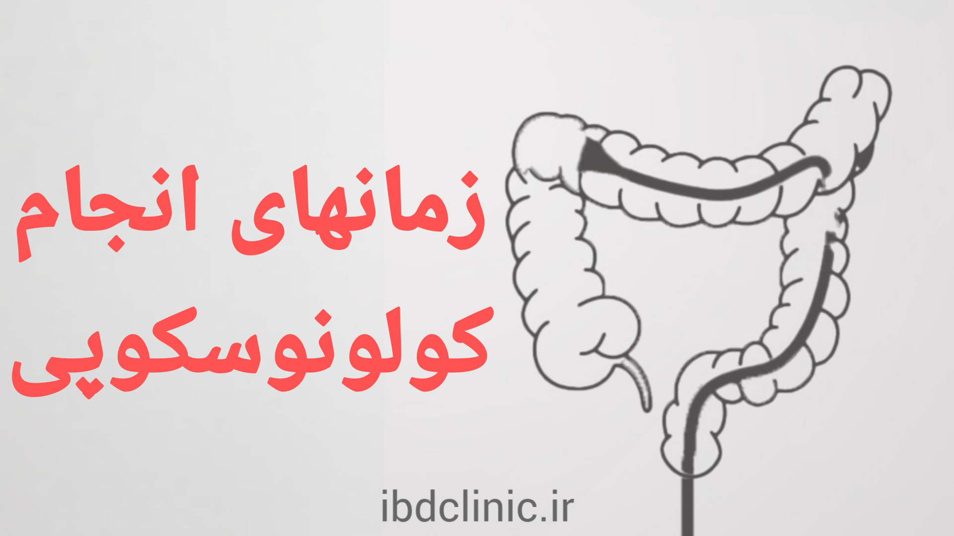 اپیزود دهم، در چه زمانی انجام کولونوسکوپی در بیماران مبتلا به ibd ضروری است؟ دكتر عليرضا سيما