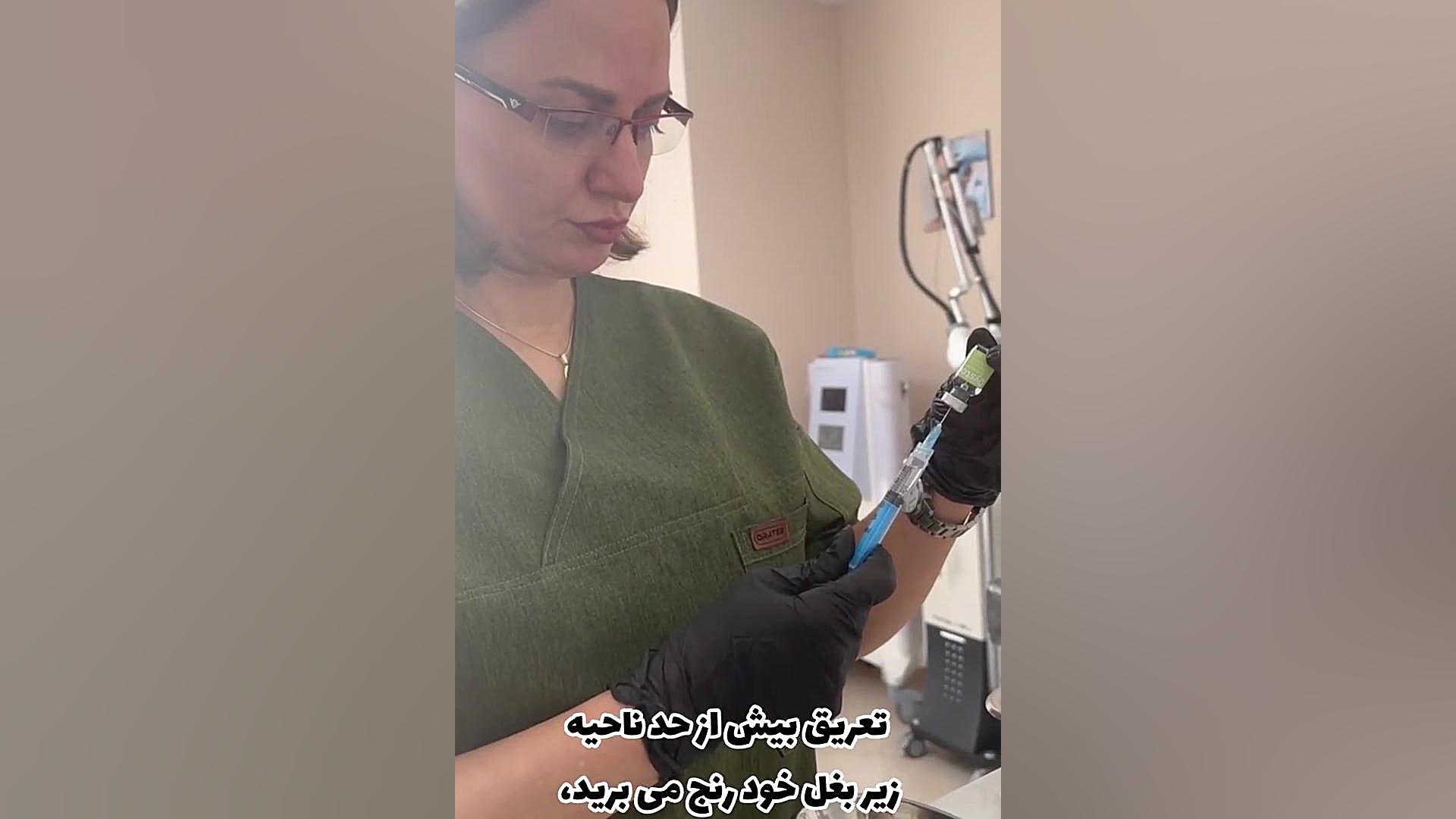 تزریق بوتاکس زیر بغل دندان پیش