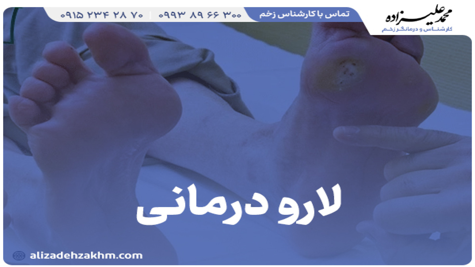 ماگوت تراپی زخم در مشهد درمانگر زخم(دکتر محمد علیزاده)