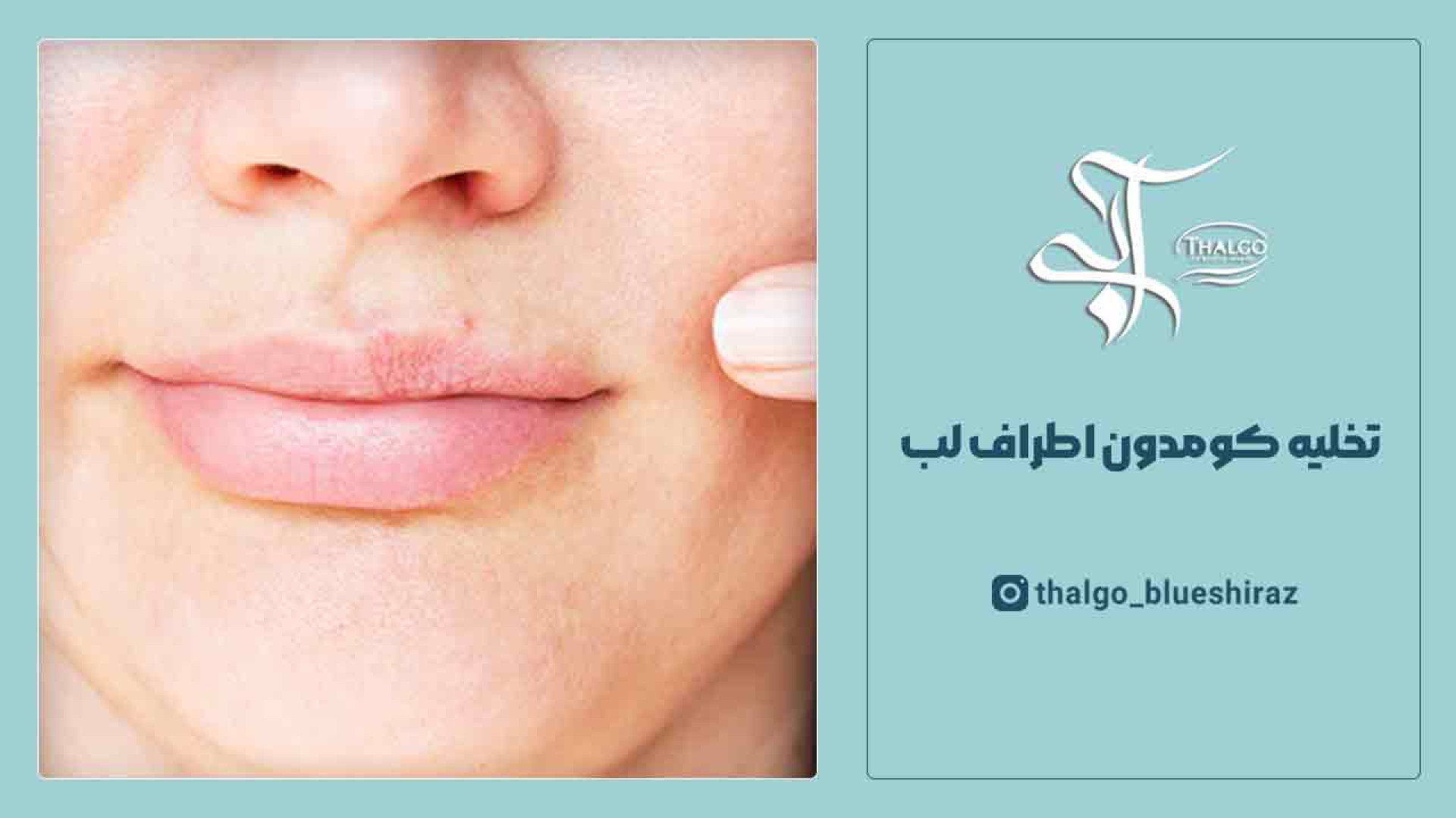 تخلیه کومدون اطراف لب | کلینیک پوست، مو و زیبایی تالگو آبی پروتز دندان