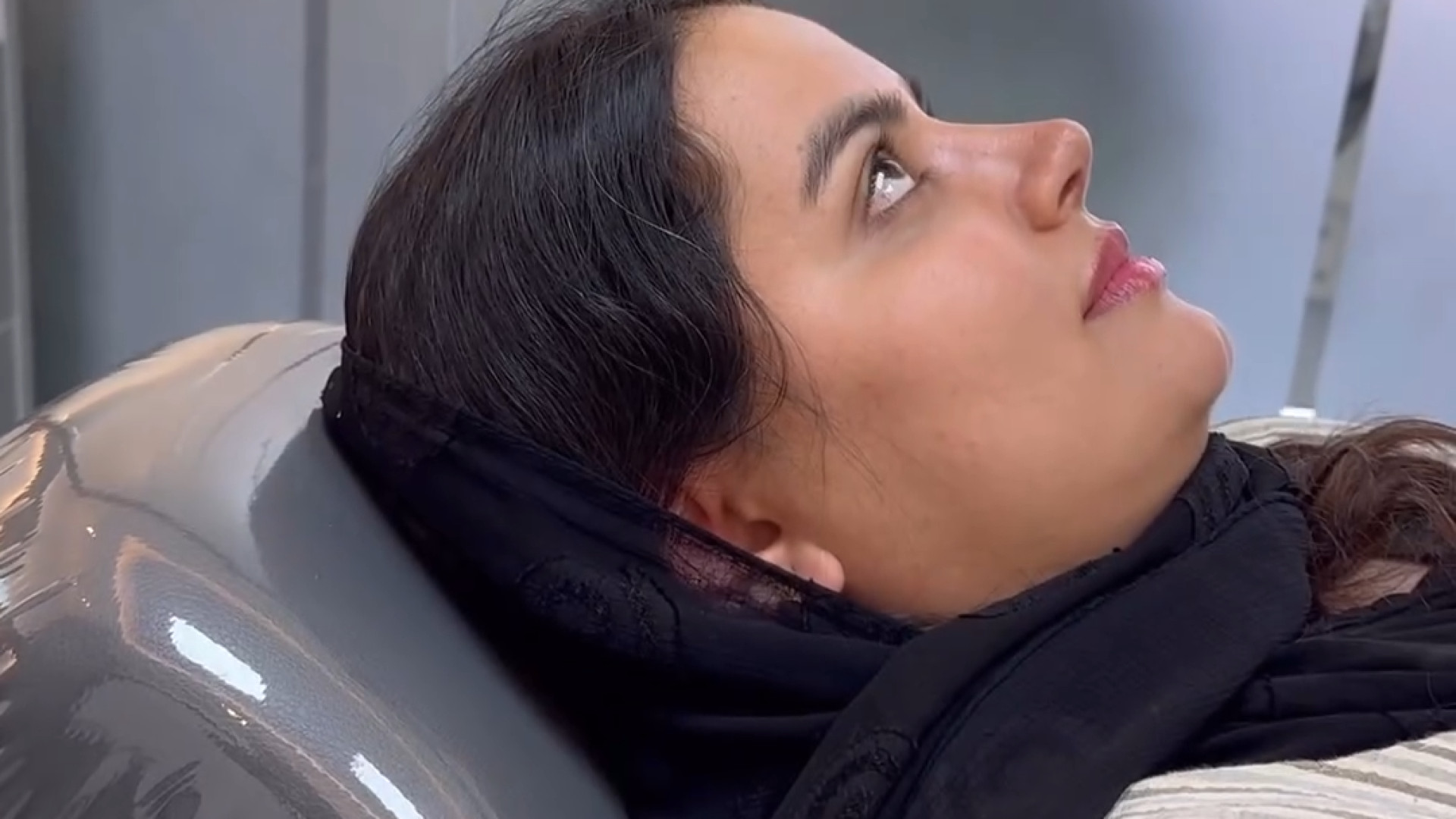 نمونه بینی گوشتی | دکتر مهدی بنائی