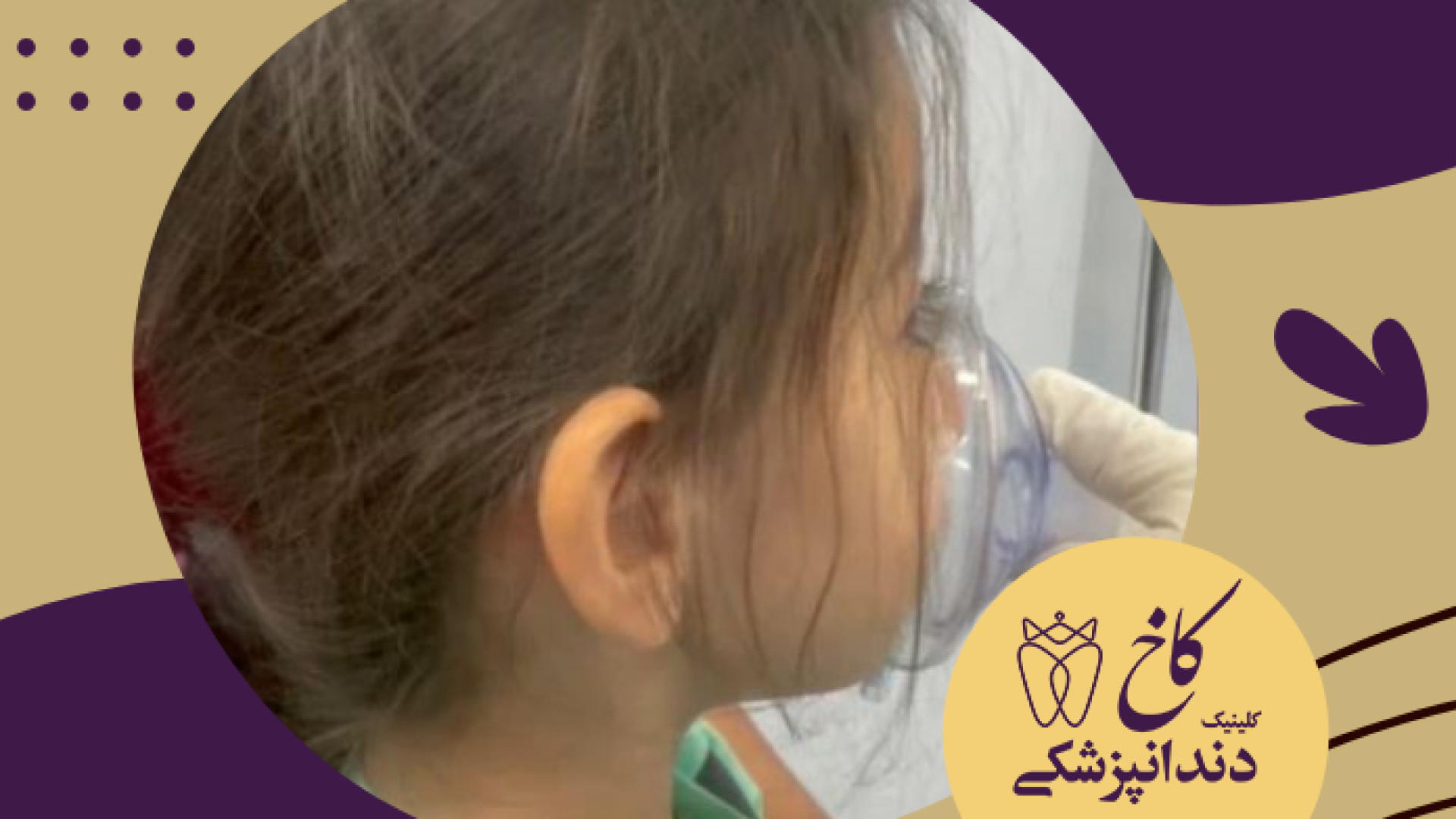 دندانپزشکی با بیهوشی برای آنیسا جون مزوتراپی