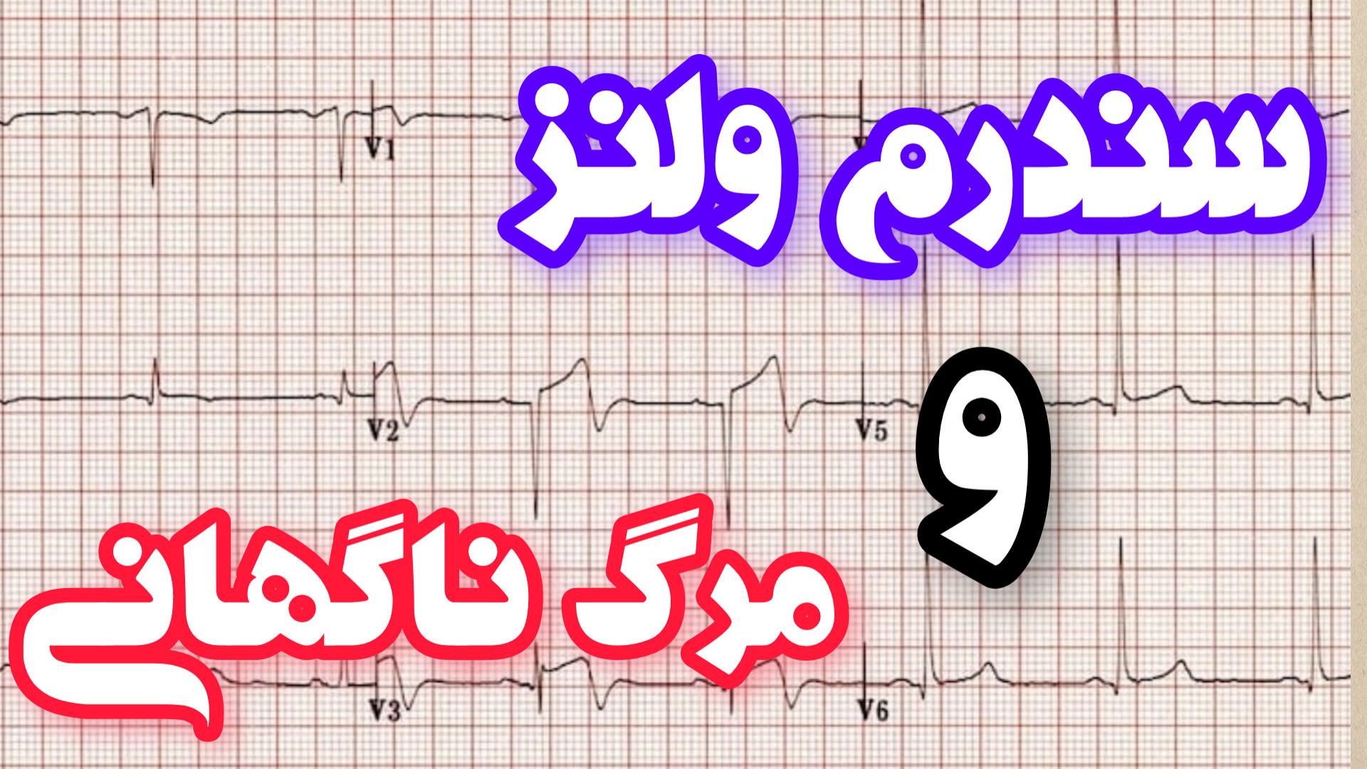 سندرم ولنز در نوار قلب Wellens Syndrome in ECG زلاتان ابراهیموویچ