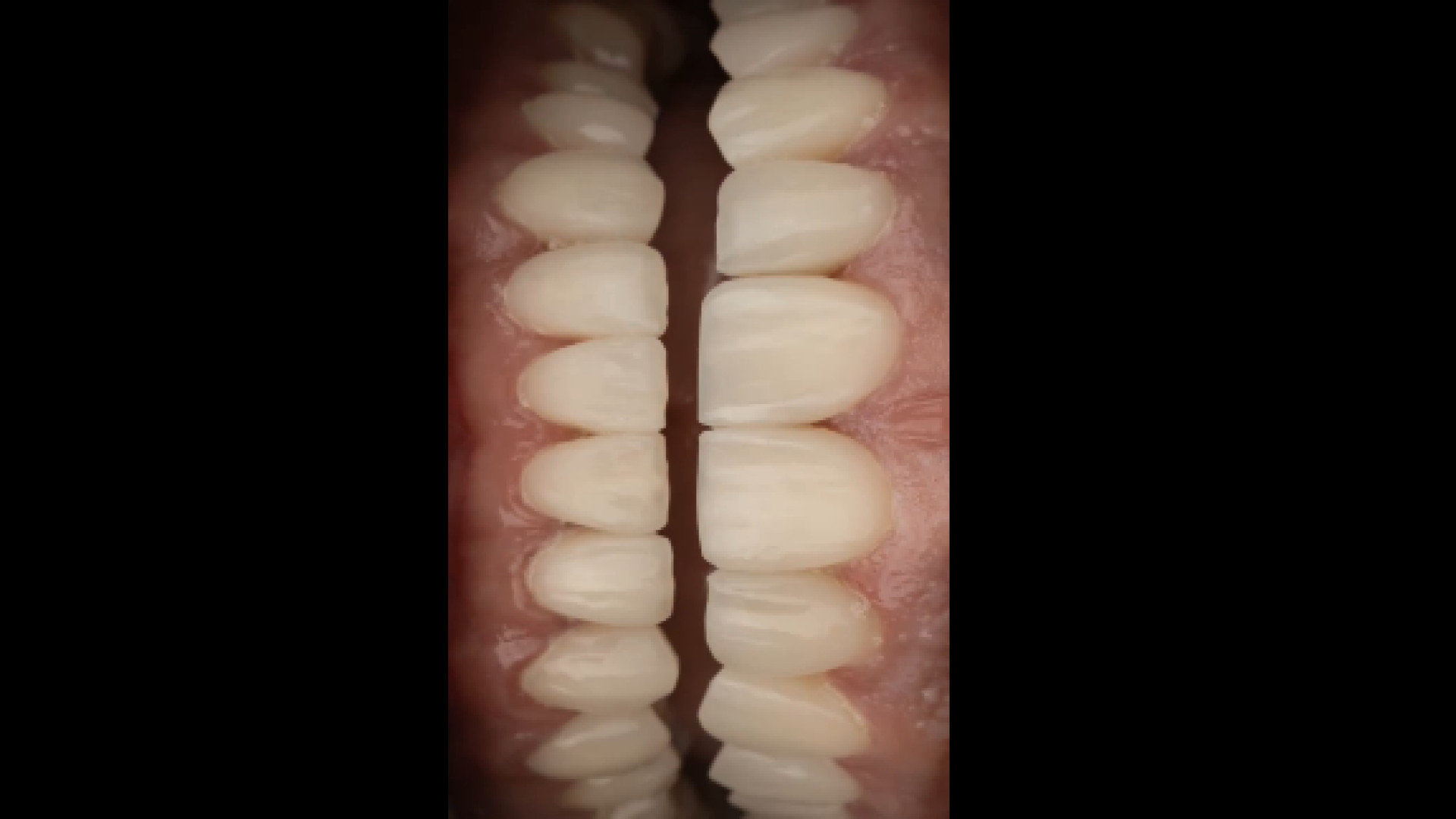 اصلاح طرح لبخند نپتوکلیب