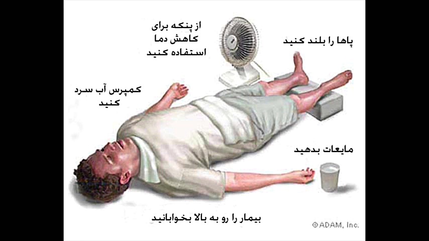 همه چیز درباره بیماری صرع لیفت صورت