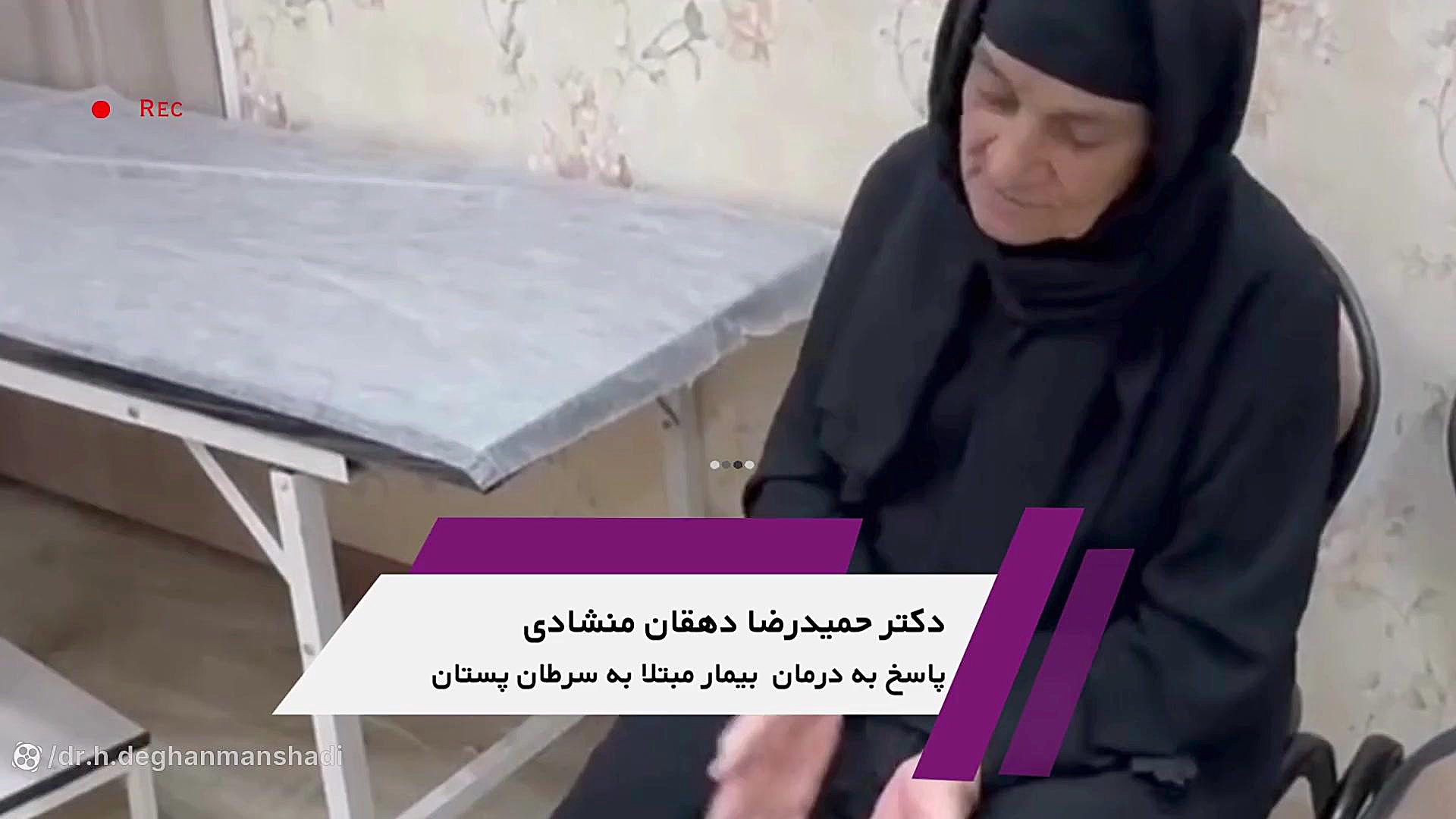 پاسخ به درمان بیمار مبتلا به سرطان پستان متاستاتیک دکتر حمیدرضا دهقان منشادی