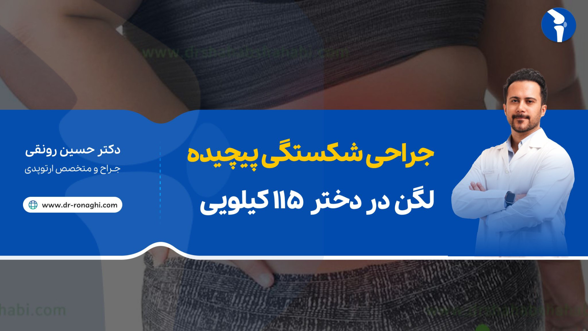 جراحی شکستگی پیچیده لگن در دختر ۱۱۵ کیلویی دکتر حسین رونقی متخصص ارتوپدی رشت آهنگ جدید