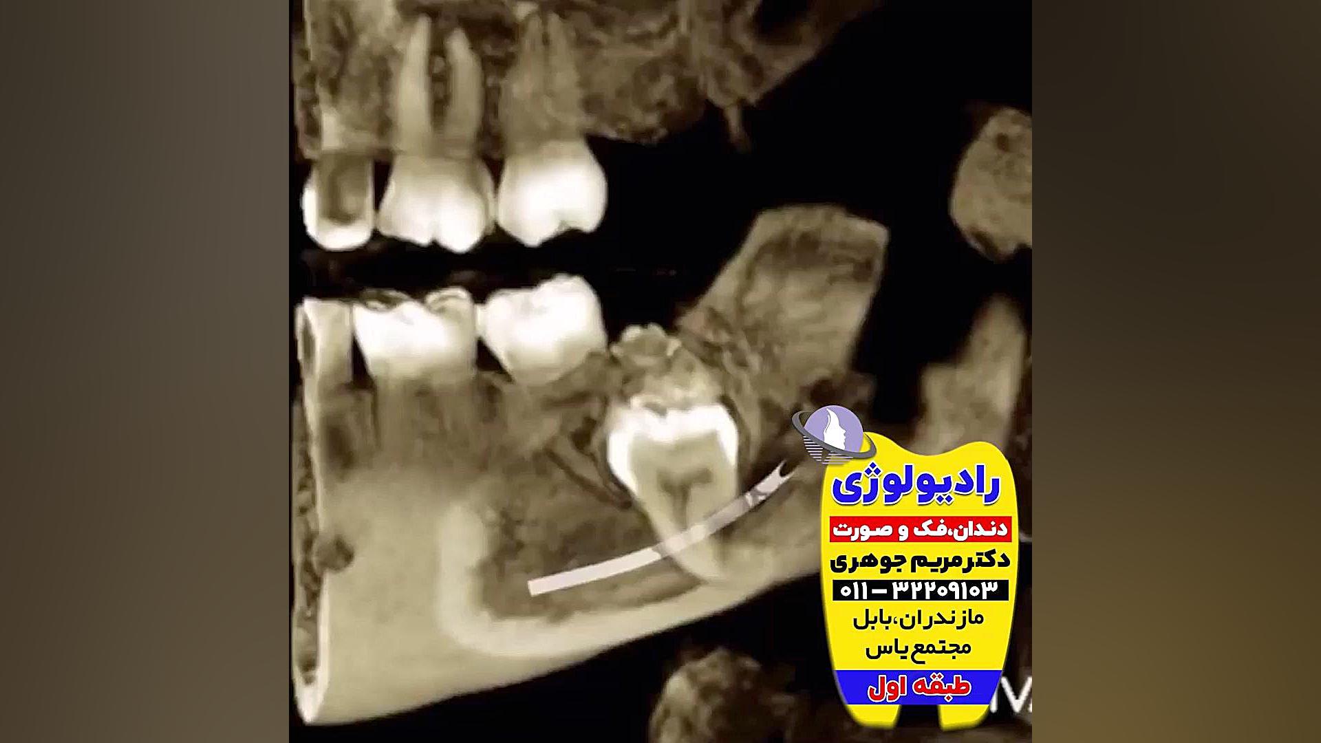 بهترین متخصص رادیولوژی بابل و بابلسر | دکتر مریم جوهری دکتر مریم جوهری