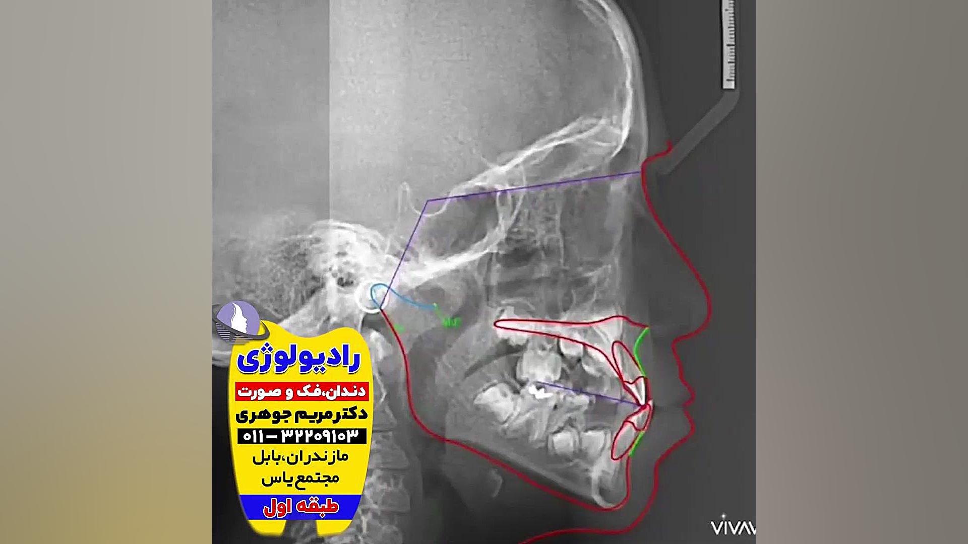 بهترین فتوگرافی چهره بابل و بابلسر | دکتر مریم جوهری دکتر مریم جوهری