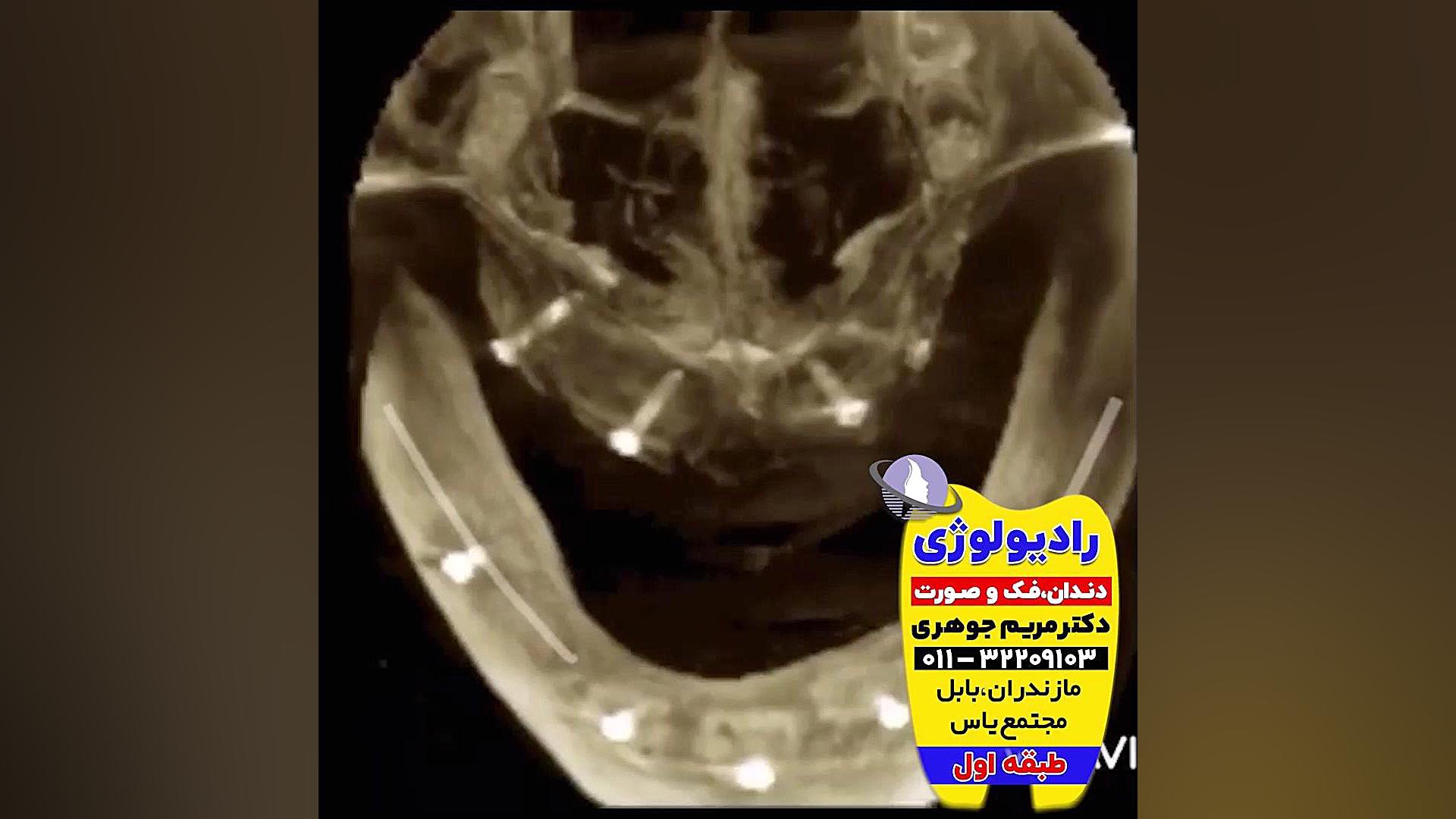 بهترین مرکز رادیولوژی فک و صورت بابل | دکتر مریم جوهری دکتر مریم جوهری