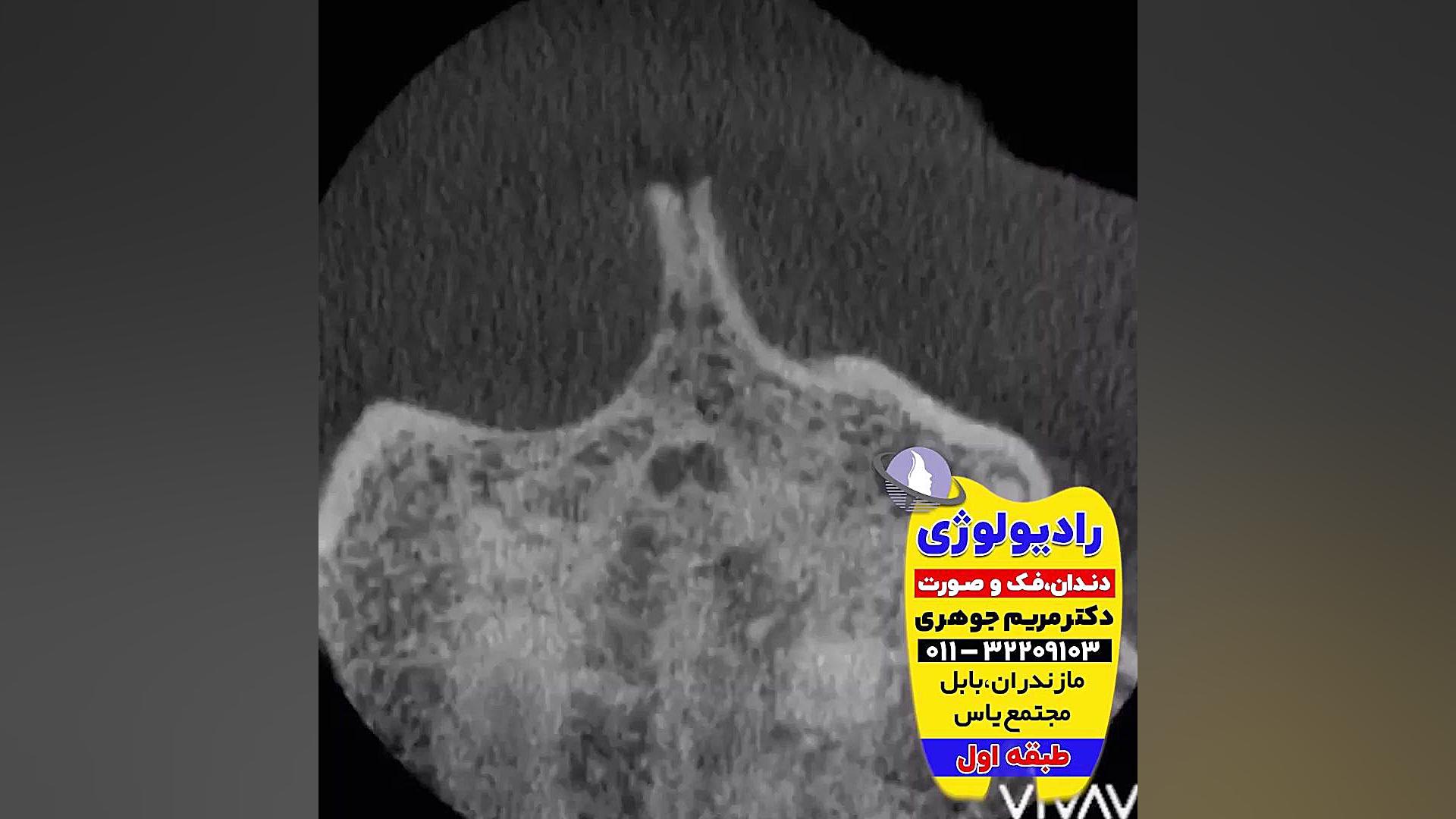 بهترین فتوگرافی چهره آمل و قائمشهر | دکتر مریم جوهری دکتر مریم جوهری