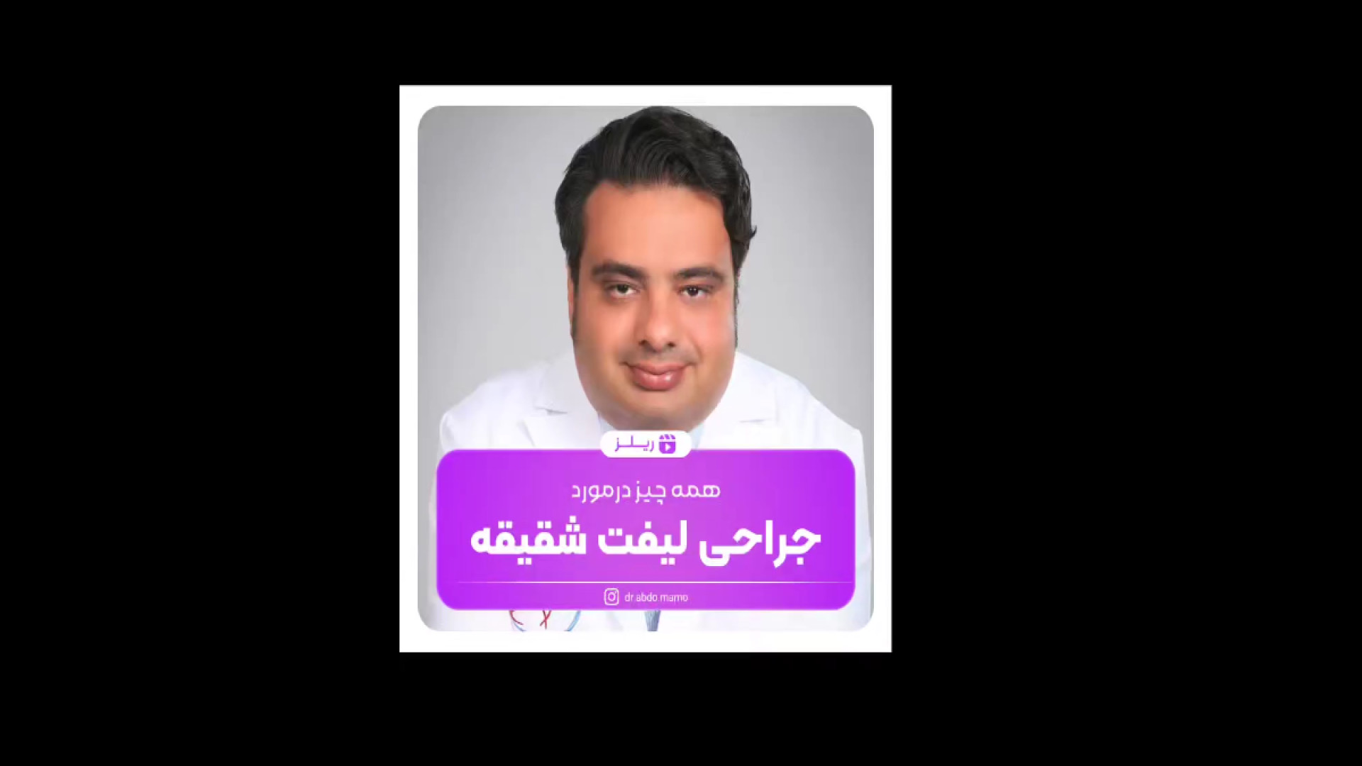 لیفت شقیقه در شهریار و تهران دکتر خشایار سنجری متخصص جراحی جنرال و زیبایی