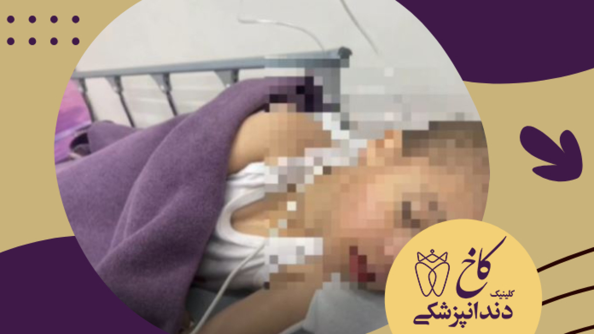 دندانپزشکی با بیهوشی برای کودکان با نیازهای ویژه کلینیک دندانپزشکی کاخ