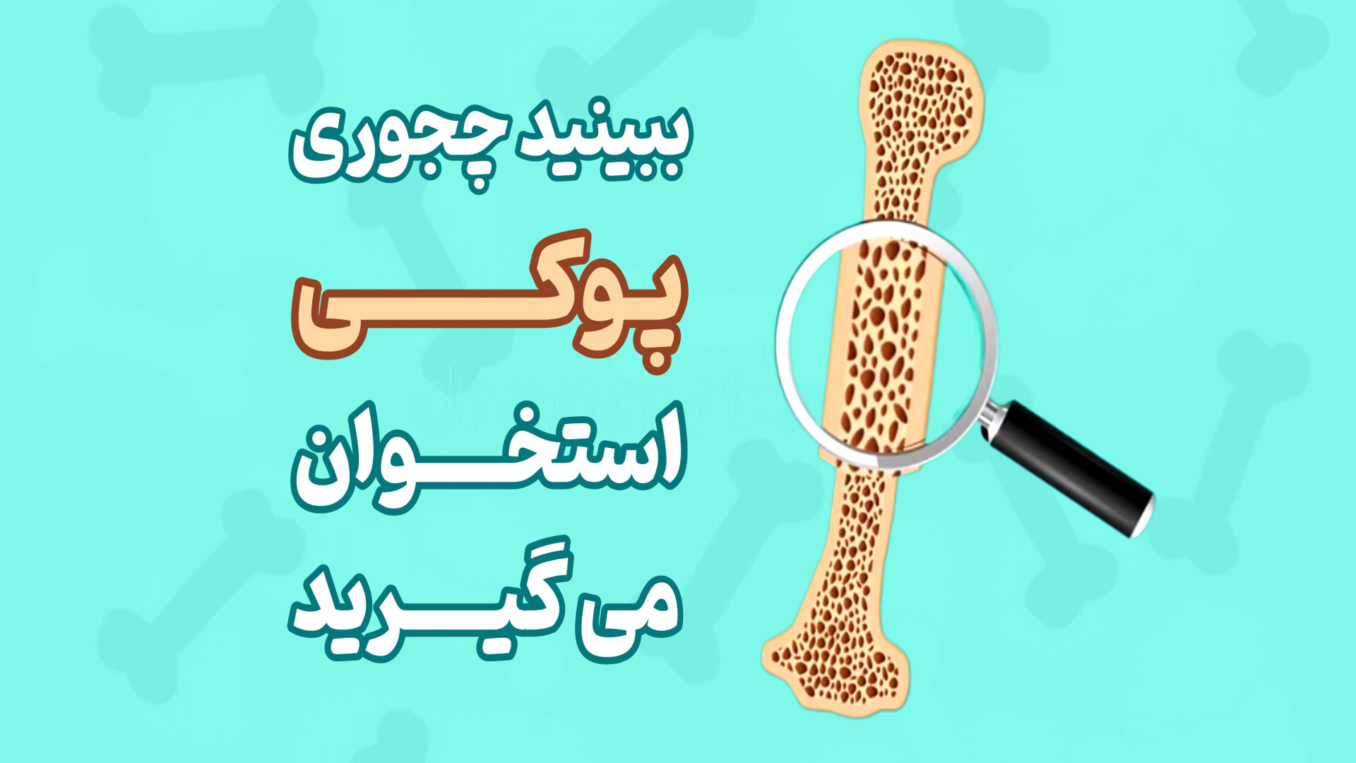 ببینید چجوری پوکی استخوان میگیرید؟ دکتر محمود جعفر بیگلو