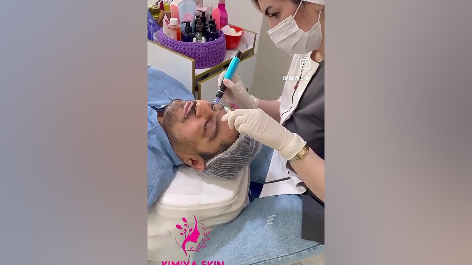 میکرونیدلینگ دور چشم Fluorescence Lifetime Imaging