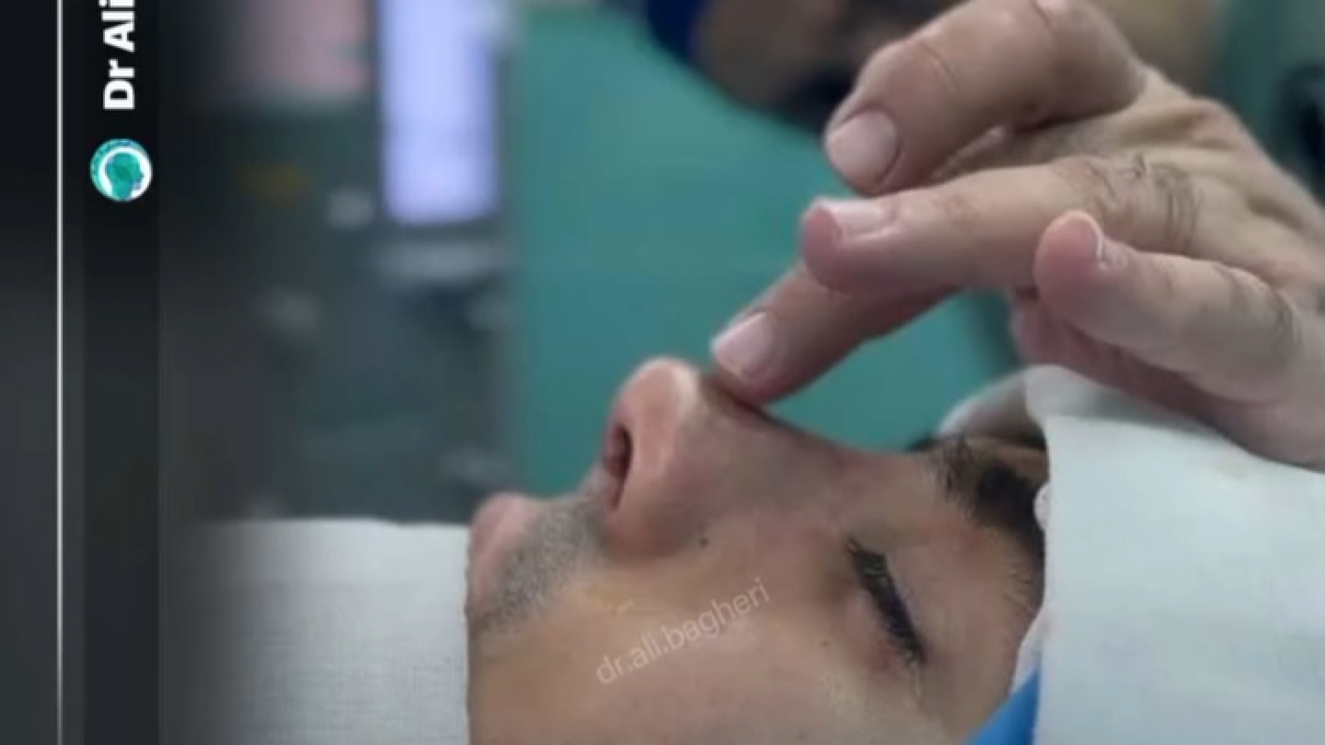 اصلاح بینی مردانه | دکتر باقری حق دکتر علی باقری حق