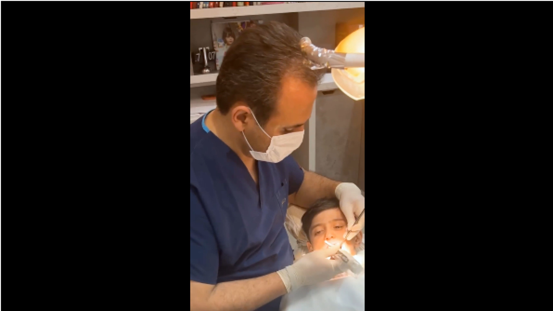 کشیدن دندان کودکان دکتر کیوان کفیلی | دندانپزشک