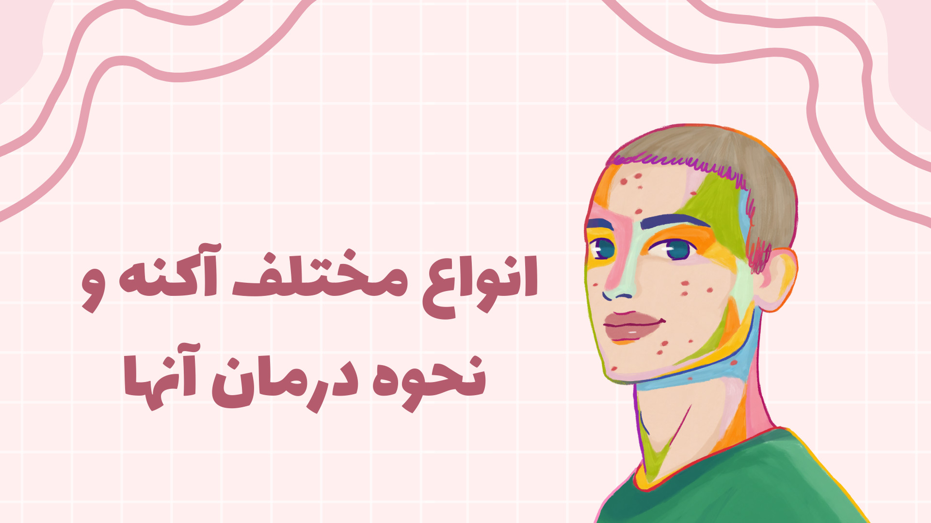 انواع مختلف آکنه و نحوه درمان آنها بررسی لک صورت