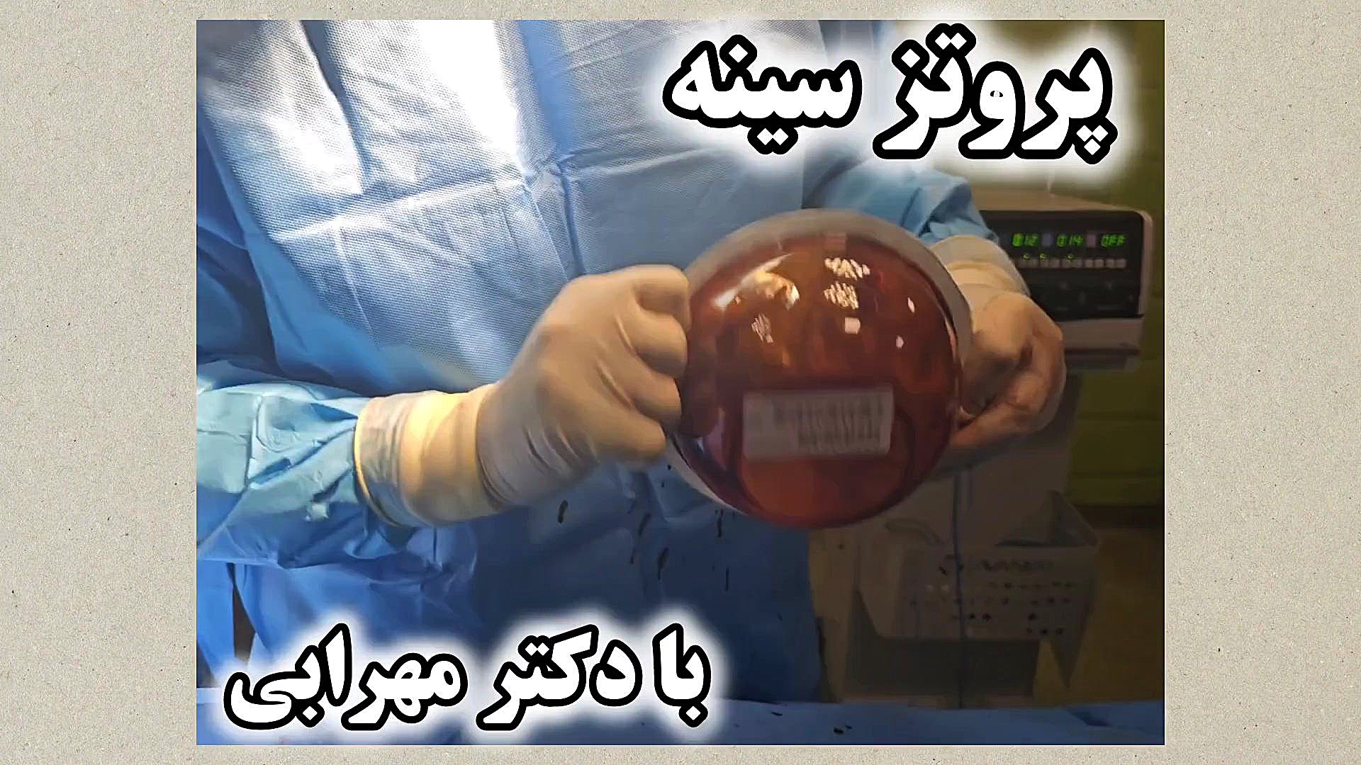 فیلم جراحی پروتز سینه شیراز دکترمهرابی دکتر محمد مهدی مهرابی جراح پلاستیک و زیبایی