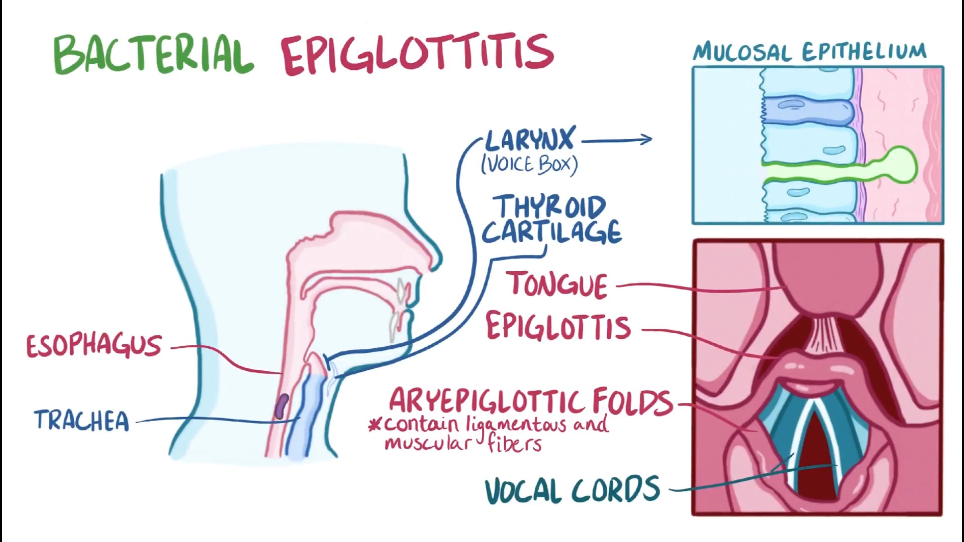 اپی‌گلوتیت و روش درمان آن استفان کری