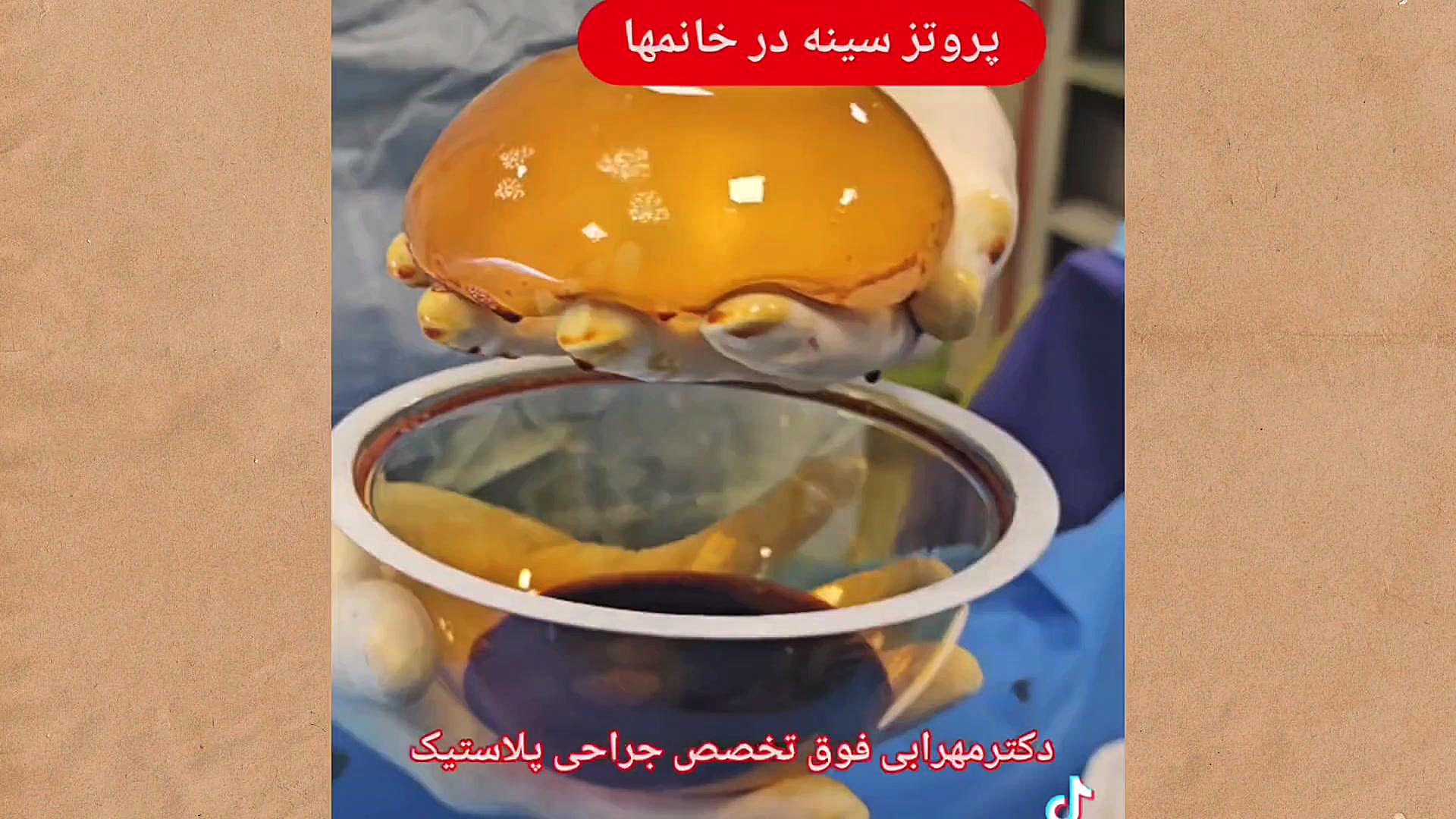 بهترین دکتر پروتز سینه در شیراز دکتر مهرابی دکتر محمد مهدی مهرابی جراح پلاستیک و زیبایی