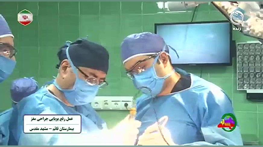 عمل بویایی مغز باند ضد باکتری نانو