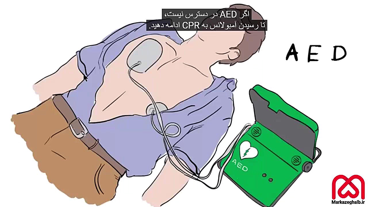 احیای قلبی ریوی (CPR) - مرکز قلب ایران درمان سلولیت