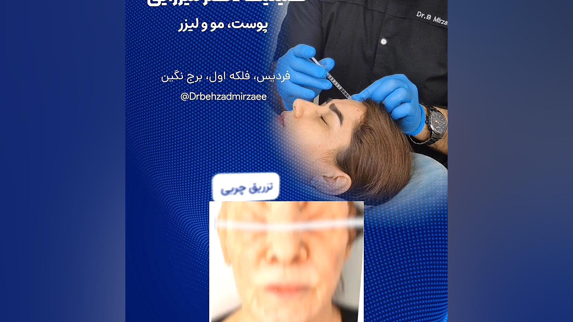 کلینیک پوست و مو و زیبایی دکتر بهزاد میرزایی هایپوفلکسی