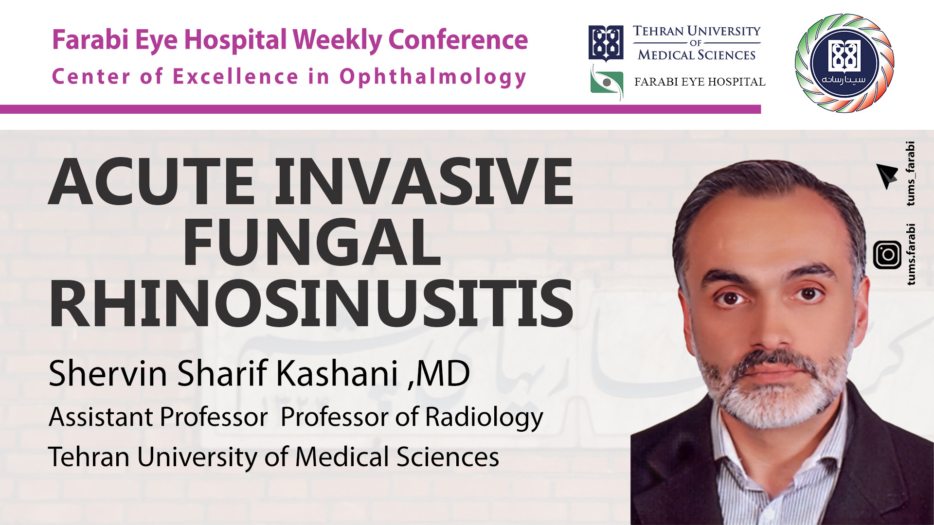 Acute invasive fungal rhinosinusitis - شروین شریف کاشانی / علوم پزشکی تهران پیلینگ شیمیایی