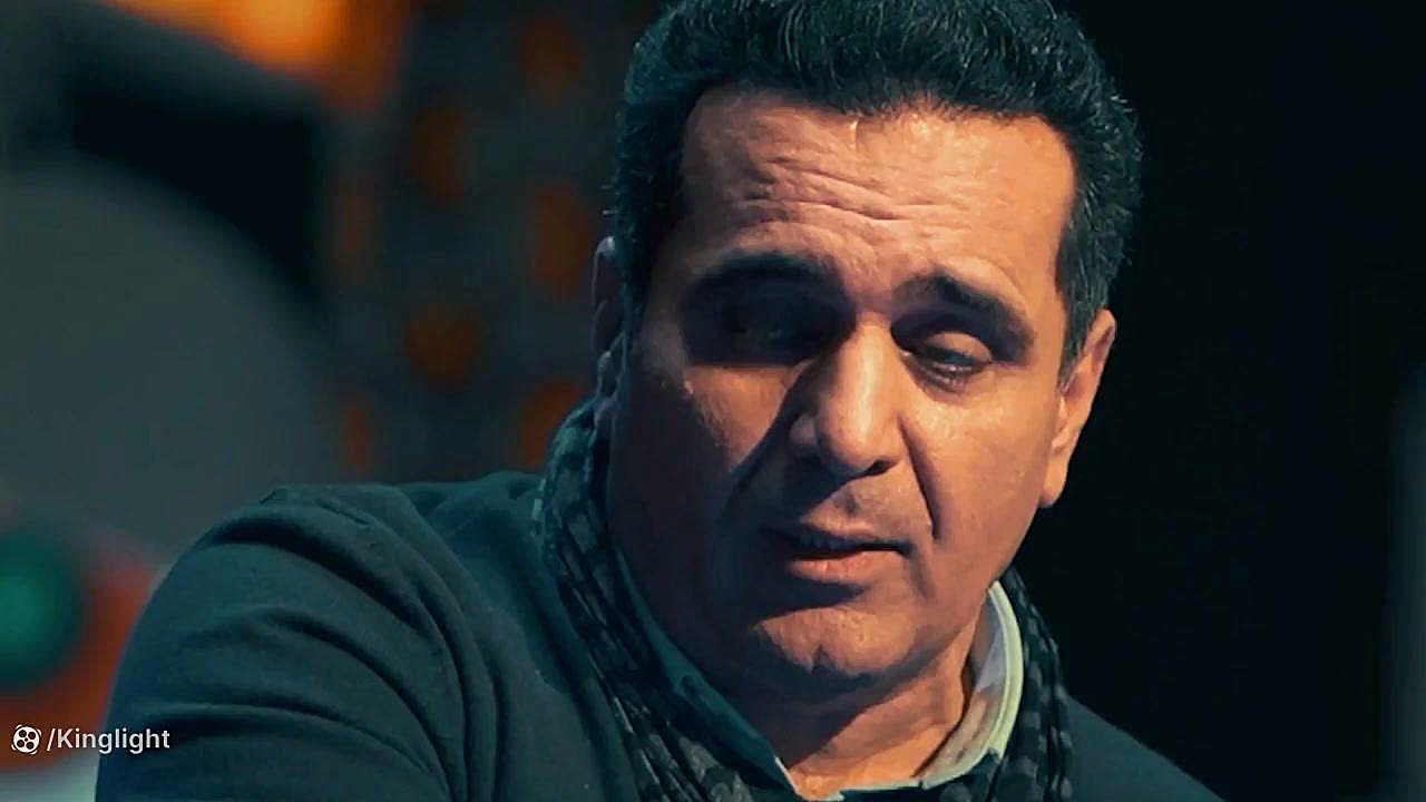 تیزر قسمت اول فصل 1 رئالیتی شو سرگیجه کاشت مو