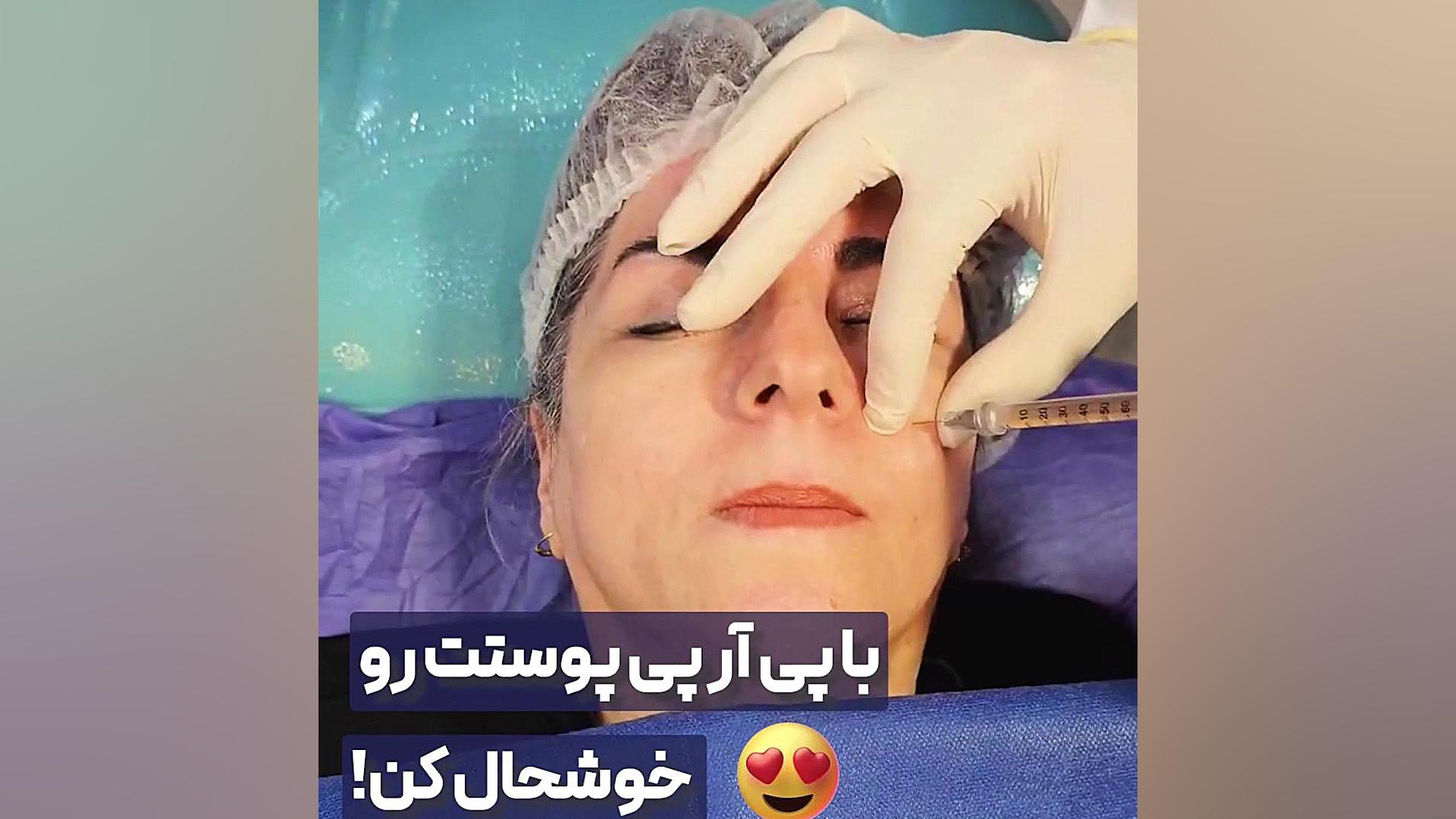 پی آر پی | دکتر علی حسینی واجاری دکتر علی حسینی واجاری - جراح بینی رشت