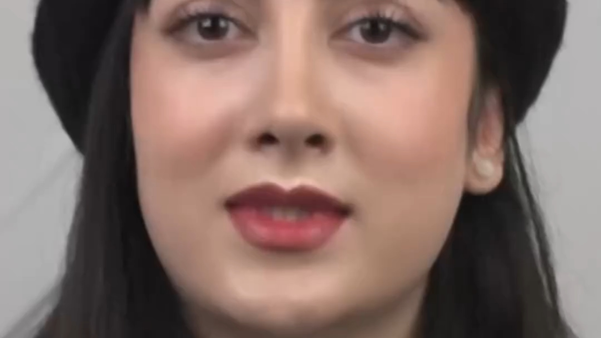 نمونه کار جراحی بینی با دکتر بشارتی زاده زیبایی پوست