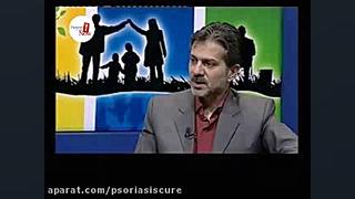 درگیری مفاصل در بیماری پسوریازیس چگونه است؟ پروتز دندان