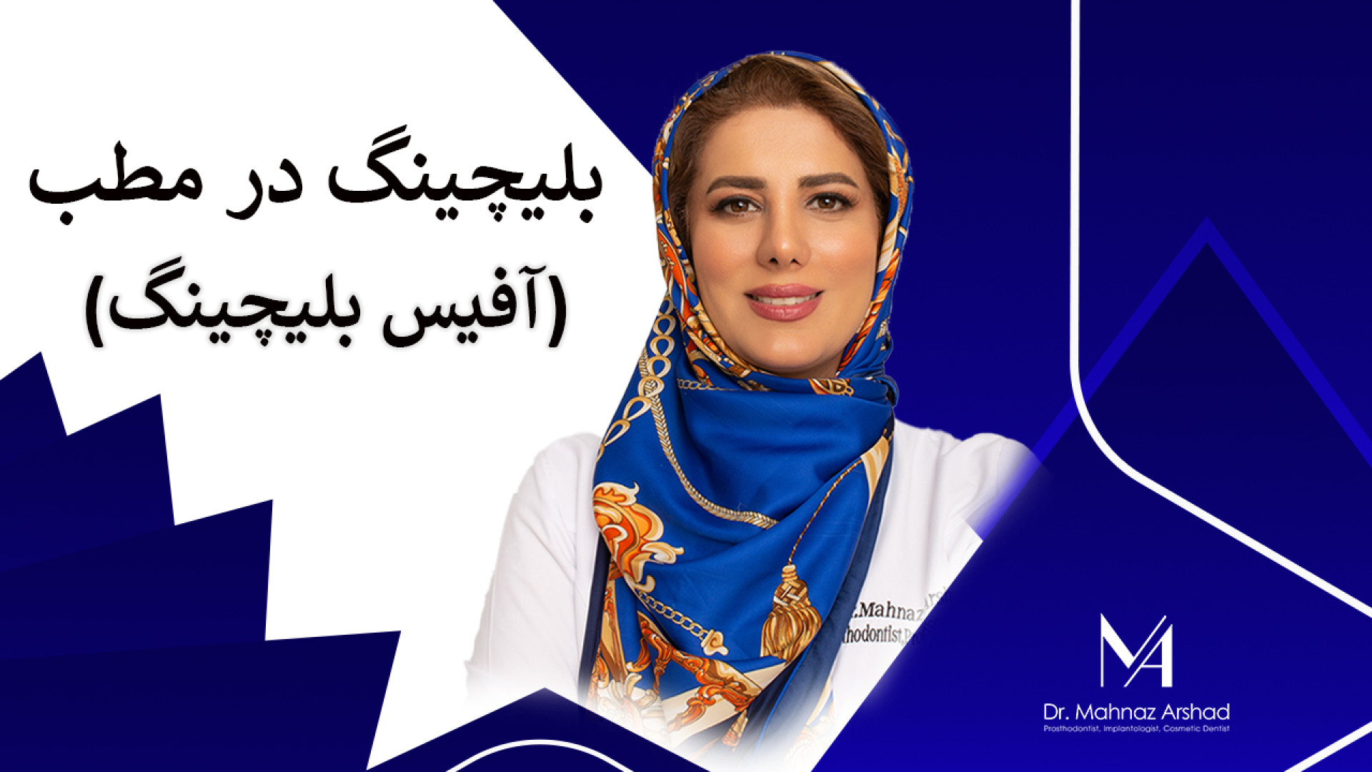 بلیچینگ در مطب دکتر مهناز ارشد