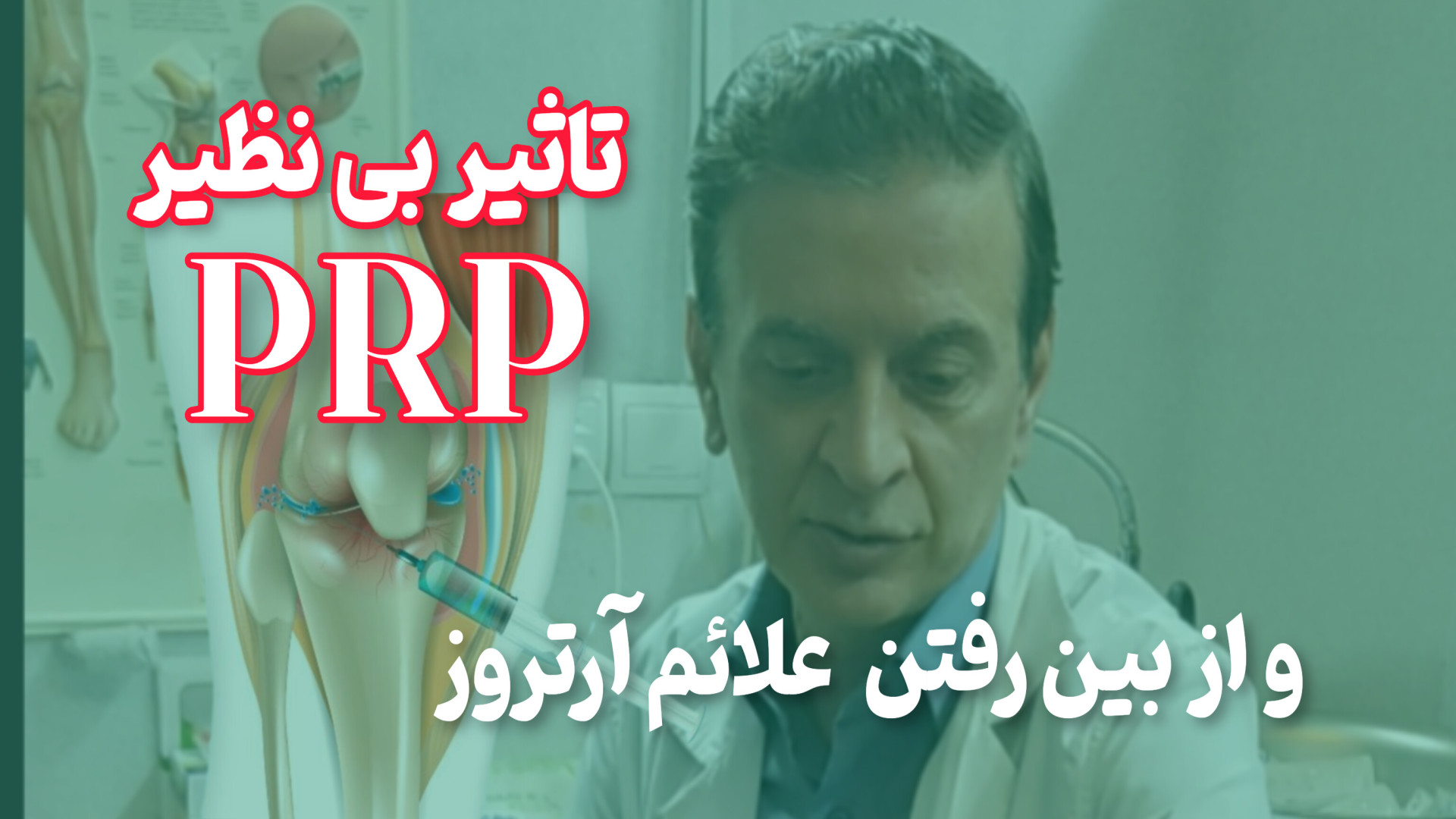 تاثیر بی نظیر پی آر پی دکتر محمود جعفر بیگلو