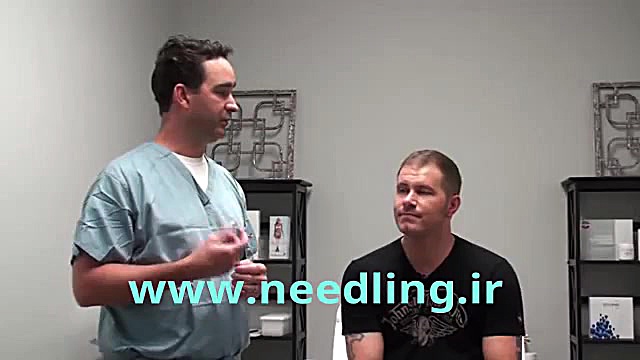 میکرونیدلینگ تقویت مو www.needling.ir تالاسمی دلتا-بتا