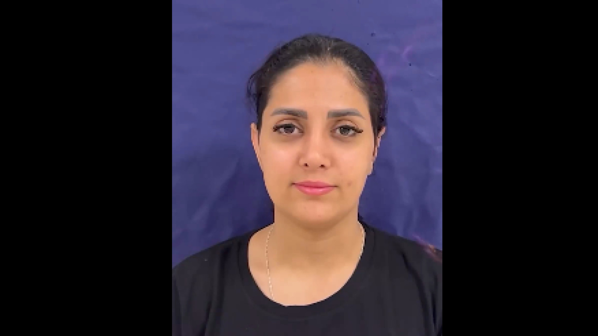 عمل جراحی اتوپلاستی همزمان با رینوپلاستی کامپوزیت ونیر