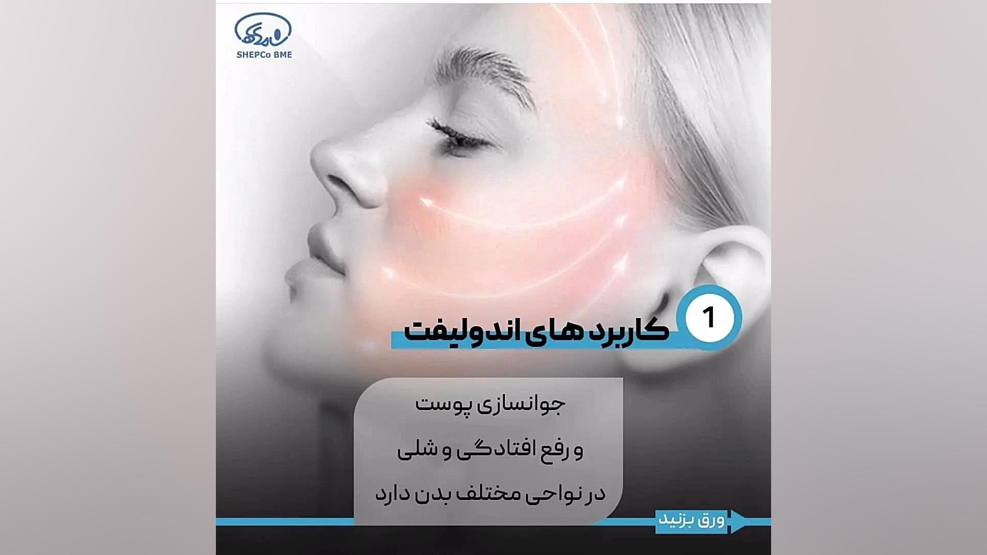 لیزر پرقدرت اندولیفت قویترین لیزر جوانساز و لیفت کننده دنیا در کلینیک پارس زنجان دکتر فرحناز زینعلی - متخصص پوست، مو، زیبایی زنجان