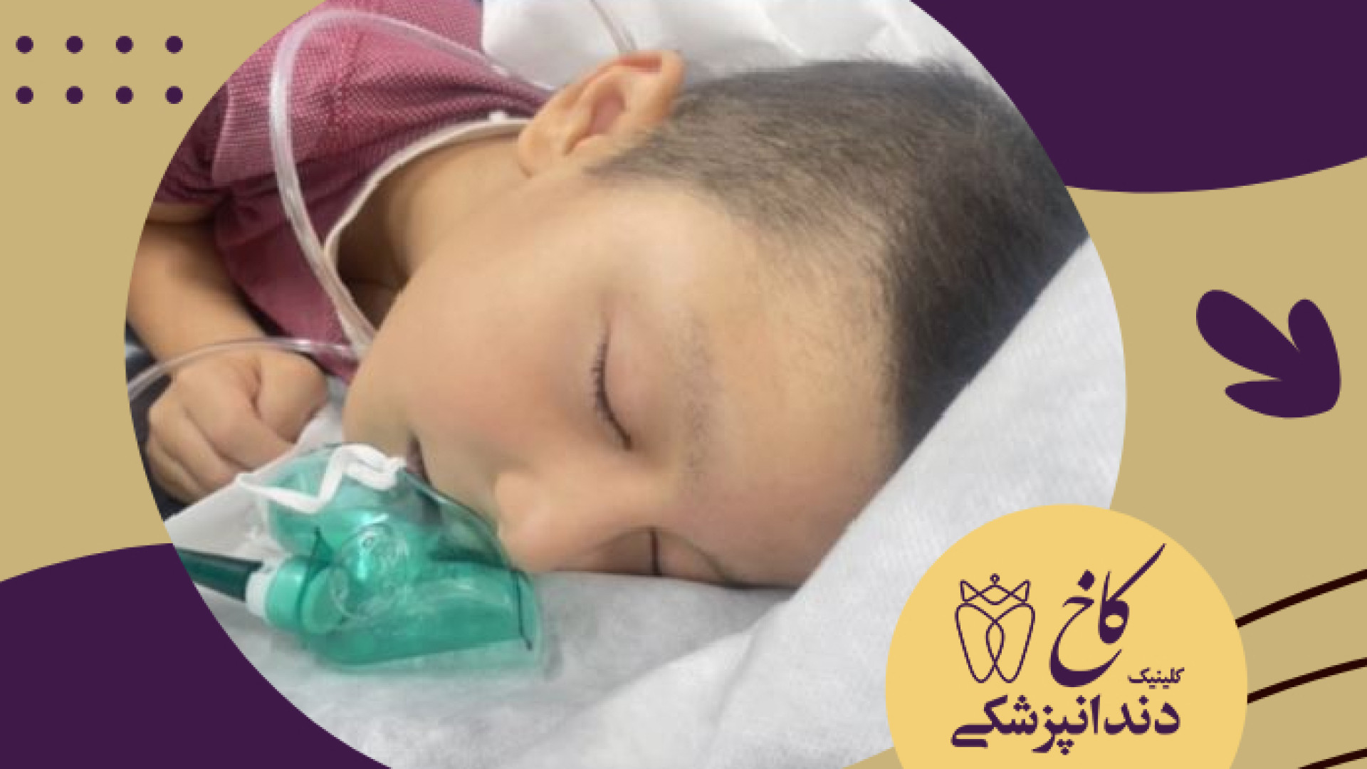 دندانپزشکی با بیهوشی برای کودکان غیرهمکار کلینیک دندانپزشکی کاخ