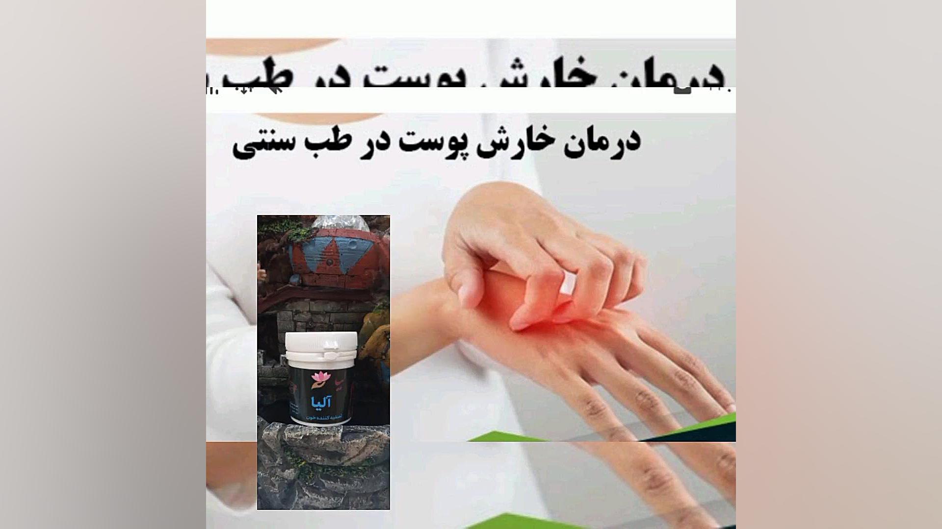 درمان خارش پوستی لیفت گردنایمپلنت دندان