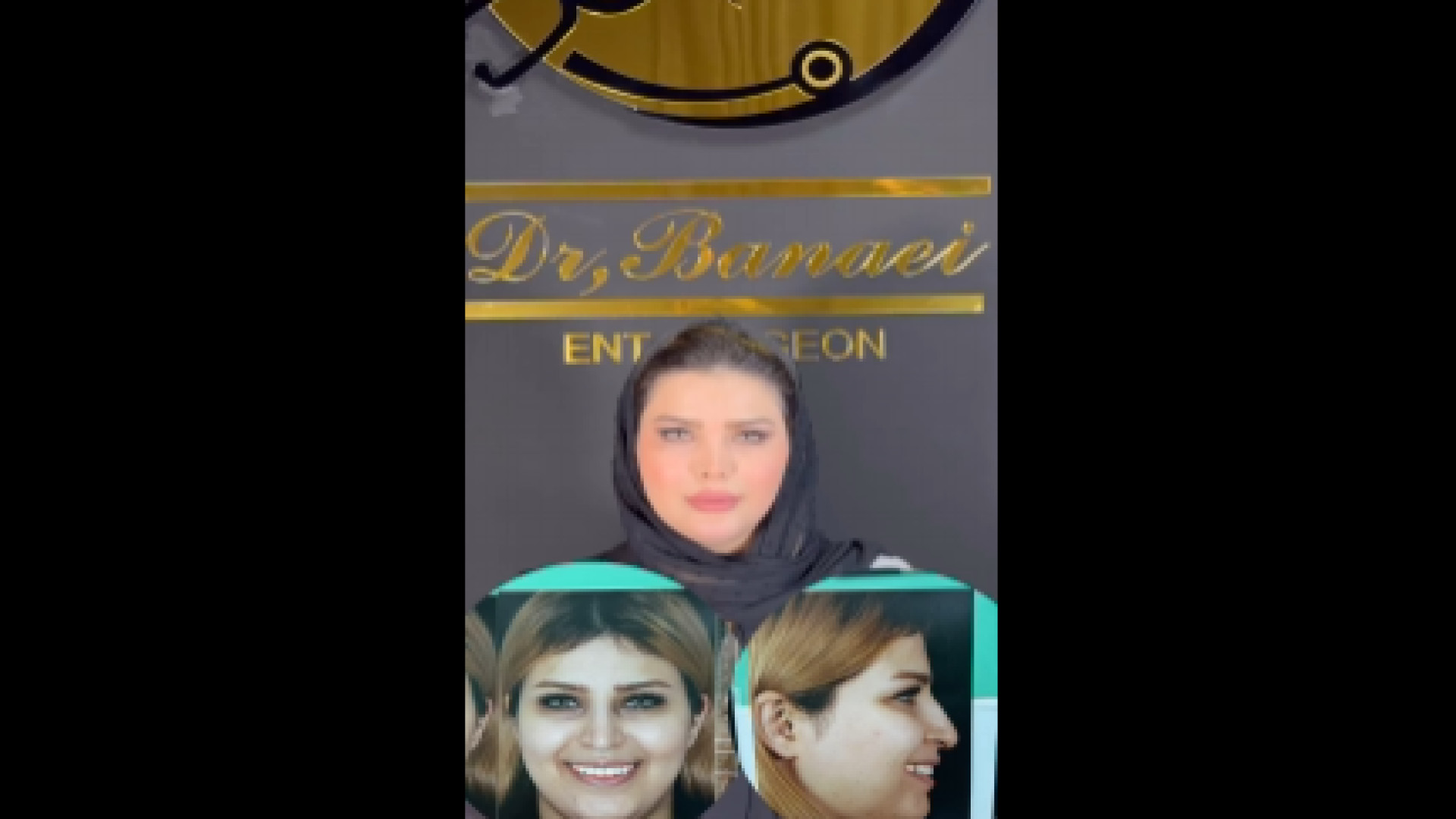 نتیجه عمل بینی | دکتر مهدی بنایی