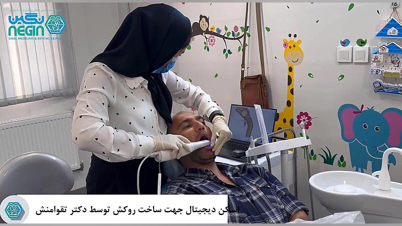 اسكن ديجيتال جهت ساخت روكش دندان توسط دكتر تقوامنش دستگاه DNA-Chip