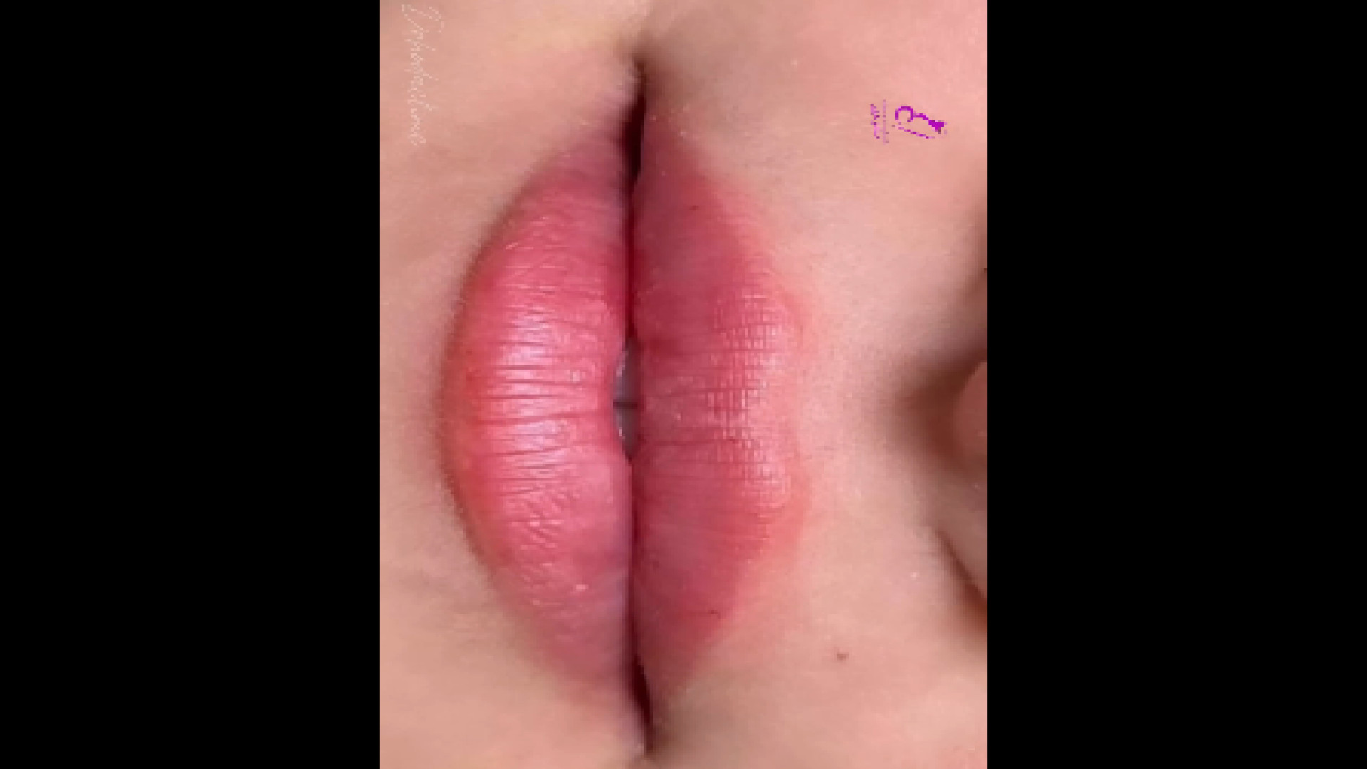 ژل لب پرشین دکتر هدی عین اللهی