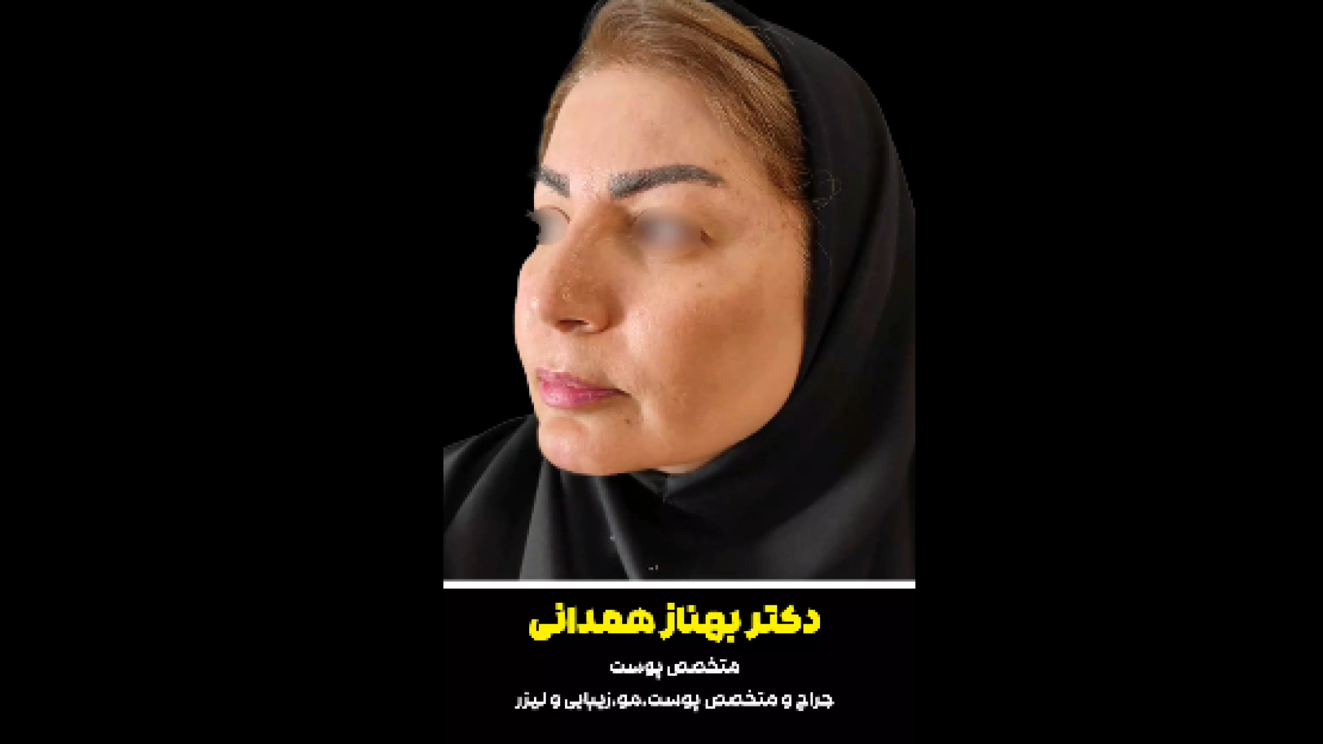 تزریق فیلر لب دکتر بهناز همدانی - متخصص پوست، مو و زیبایی