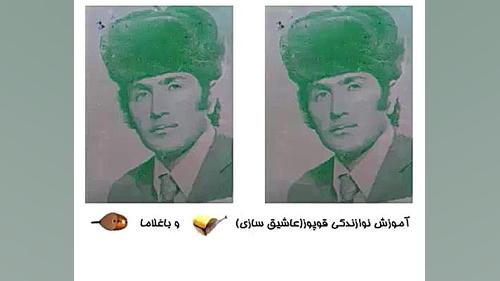 مرحوم عاشیق عبدالعلی نوری شریل و دوبیتی هاواسی تزریق بوتاکس