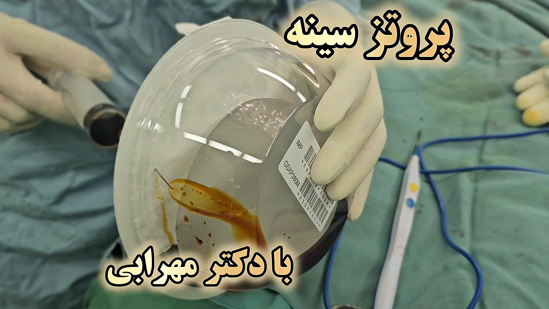 بهترین دکتر پروتز سینه در شیراز دکتر مهرابی فیلم عمل پروتز سينه دکتر محمد مهدی مهرابی جراح پلاستیک و زیبایی